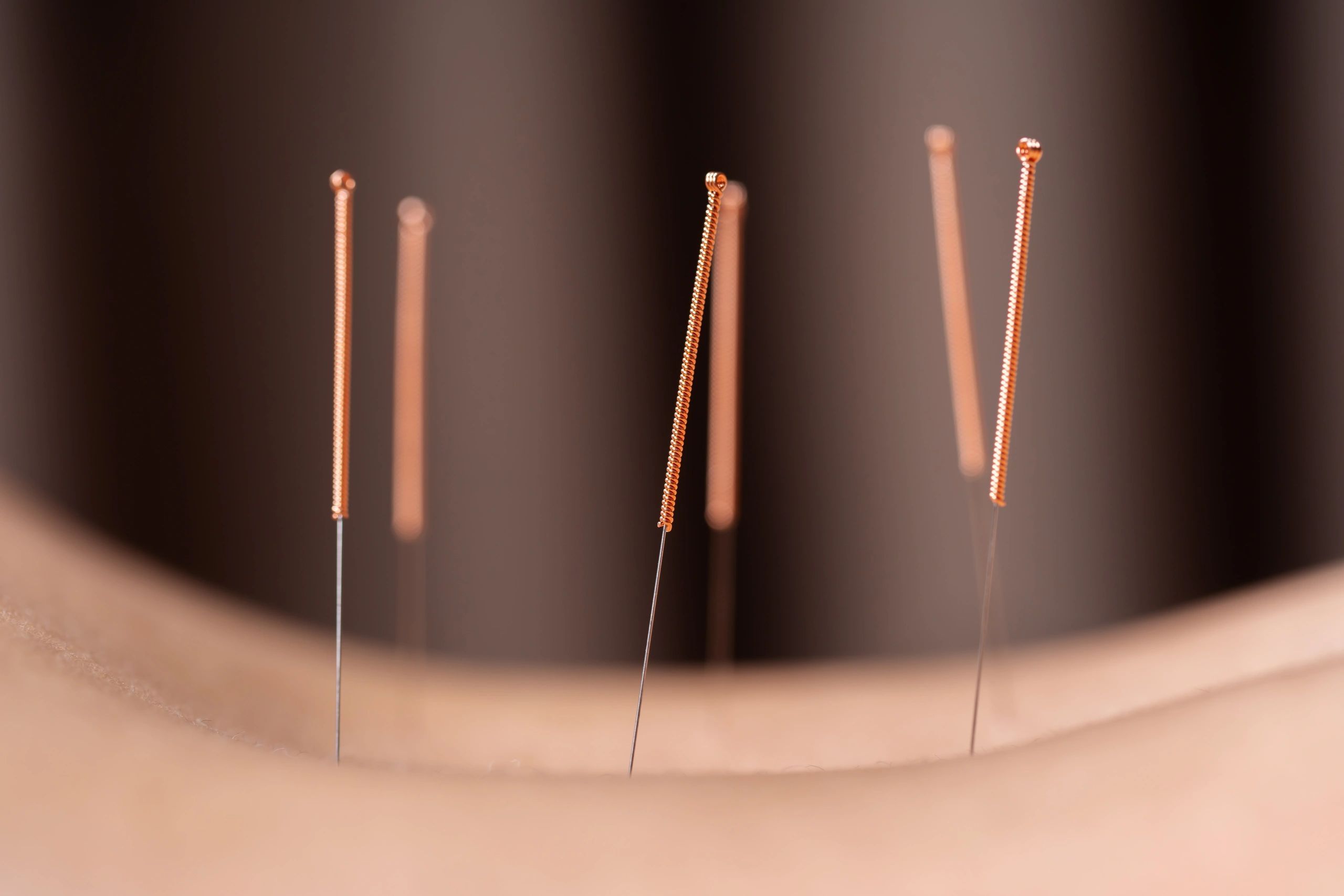 Acupuncture Wallpapers Top Free Acupuncture Backgrounds WallpaperAccess