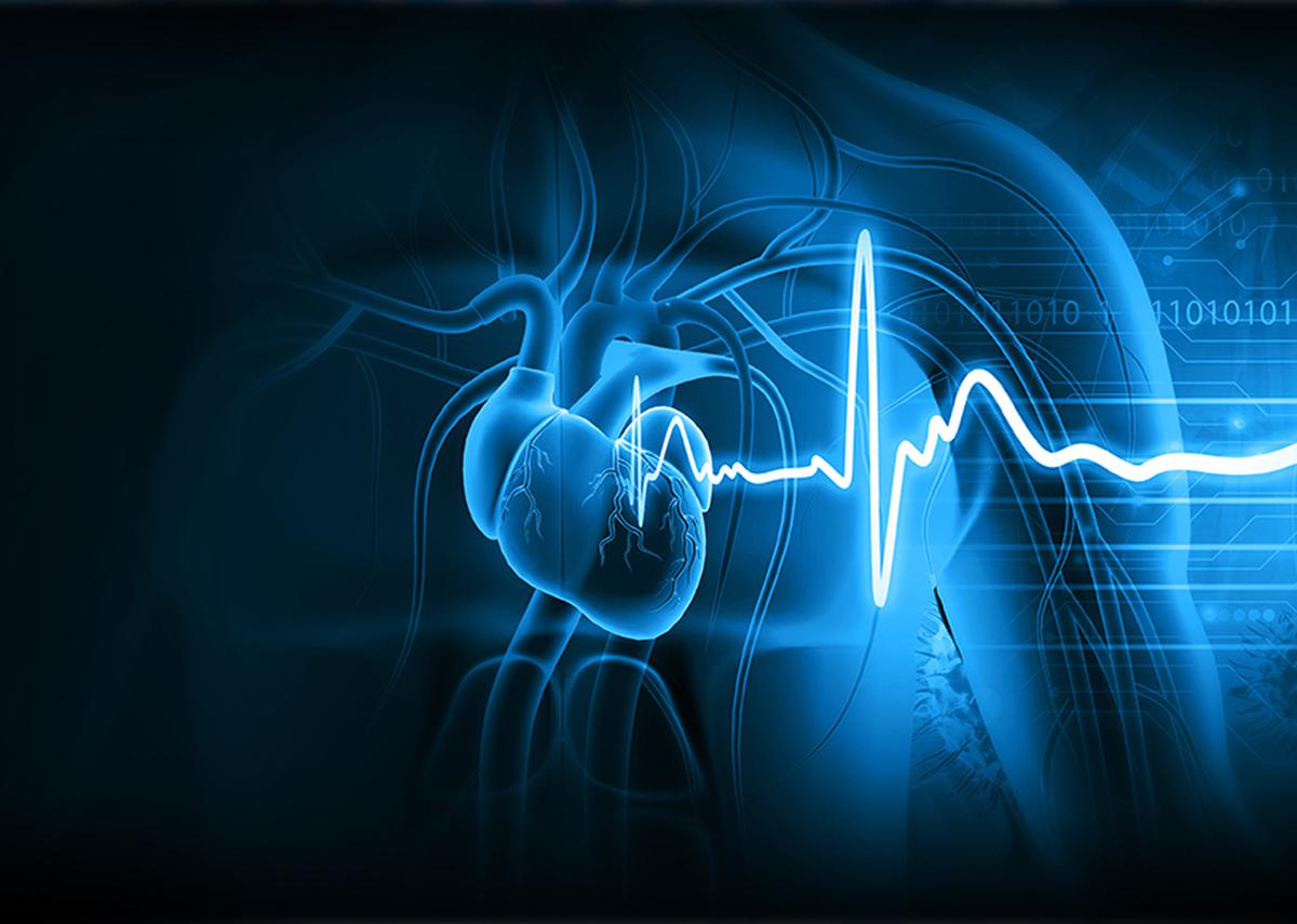 1200x855 Percentage of deaths caused by heart attack declining in Kerala