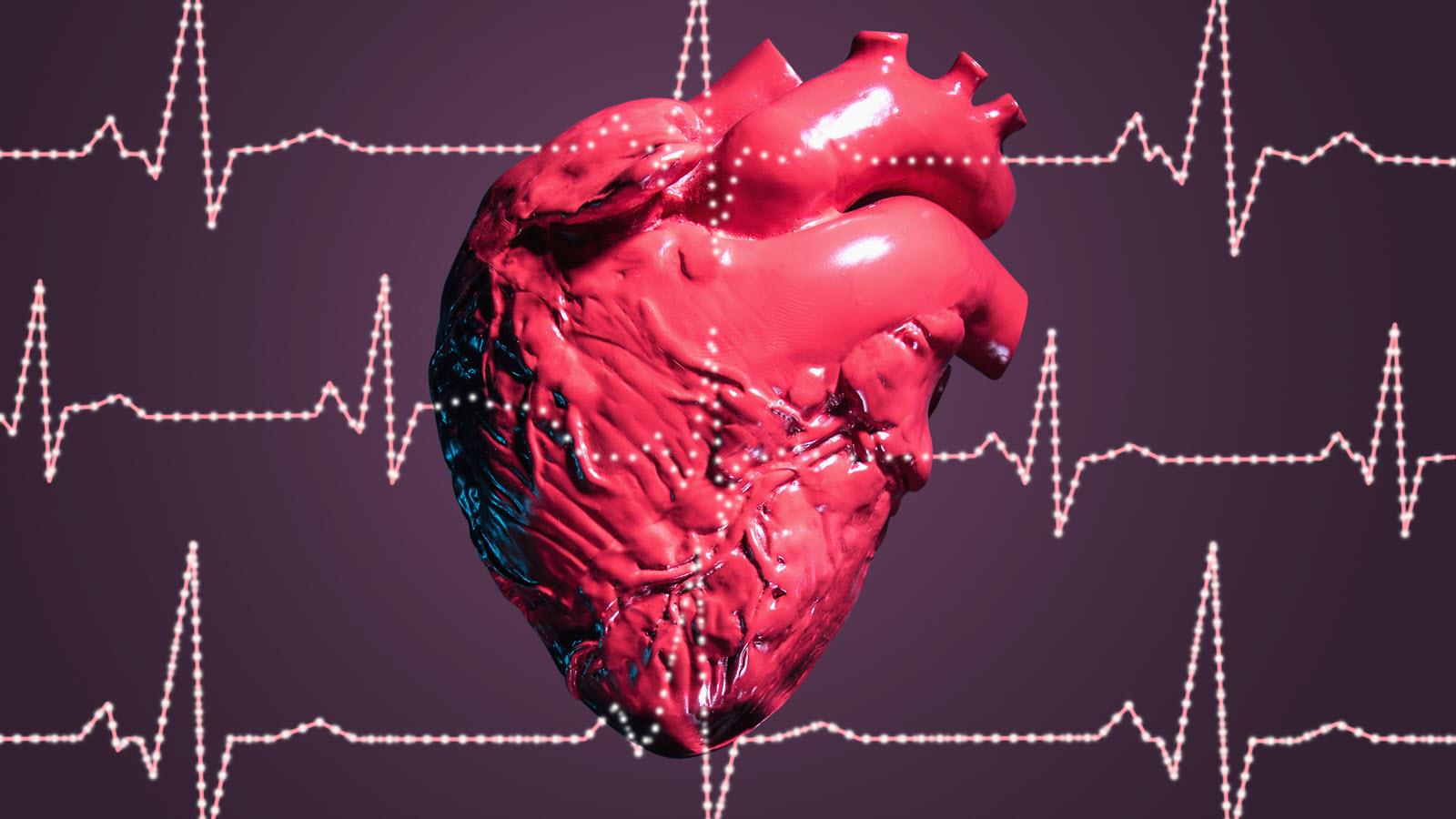 1600x900 After A Heart Attack, A 90 Day High Risk Period