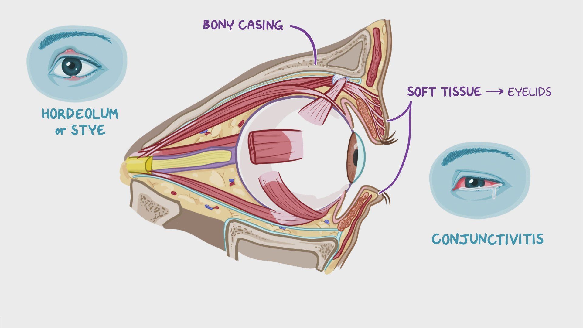 1920x1080 Anatomy clinical correlates: Eye: Video & Anatomy