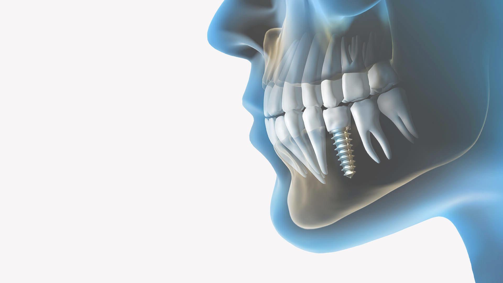 1920x1080 Tooth Care Dental Clinic in Patna Dentist in Patna