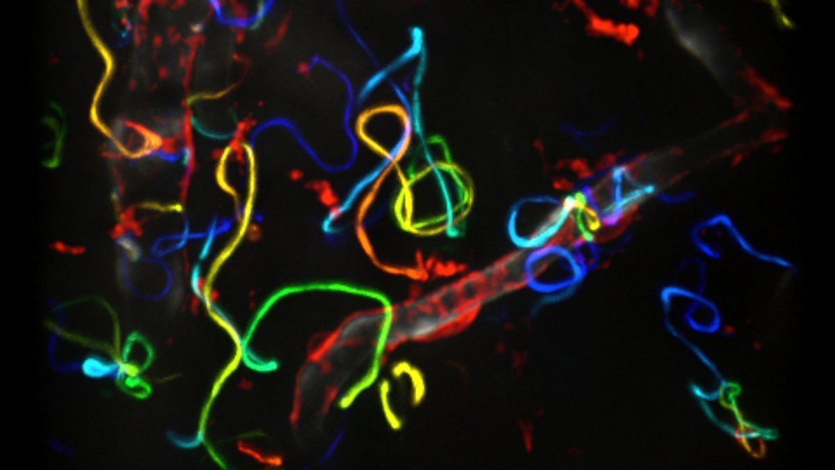 1200x675 Malaria: parasite migration strategy revealed