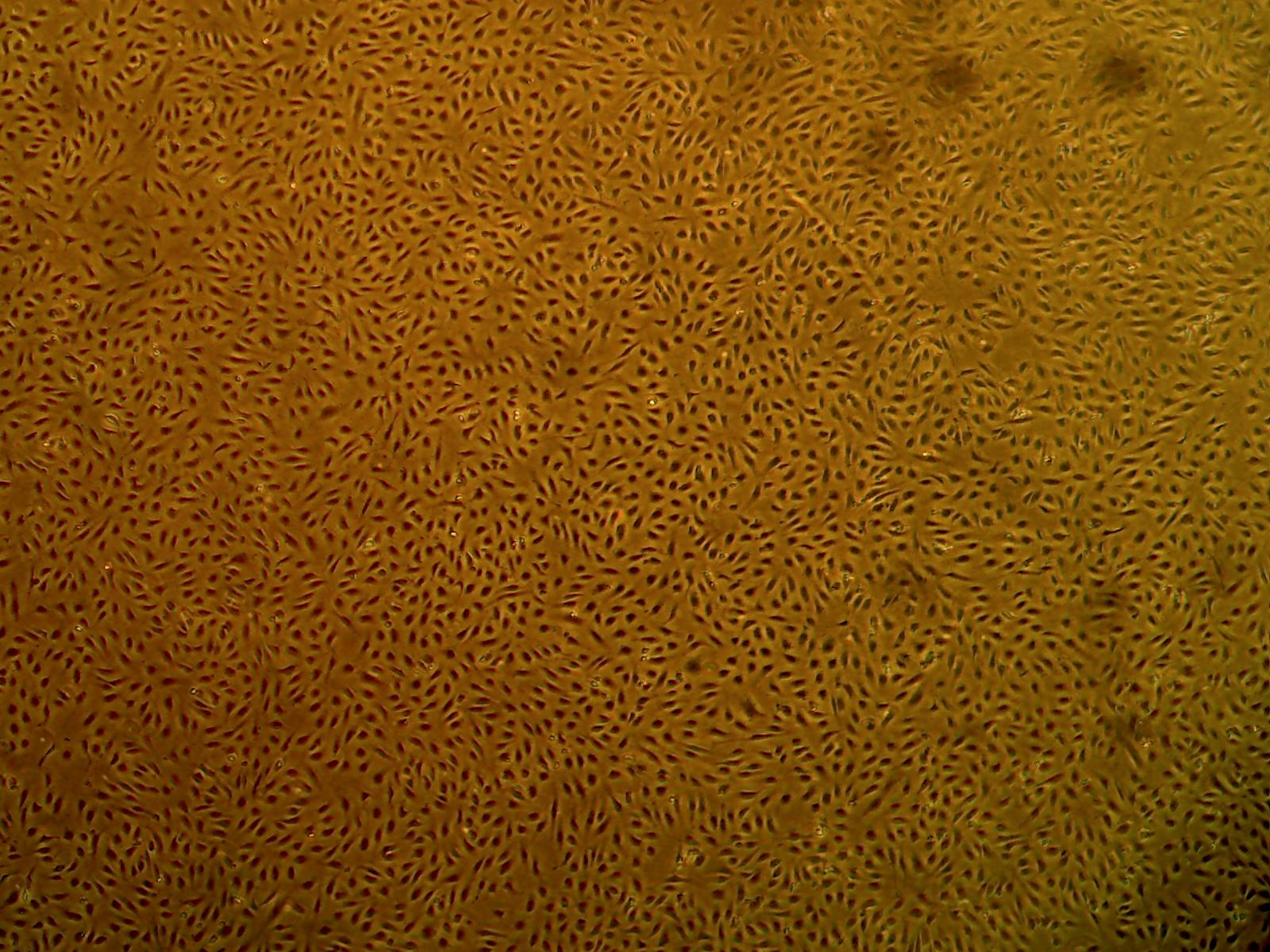 1600x1200 Primary Human Aortic Endothelial Cells