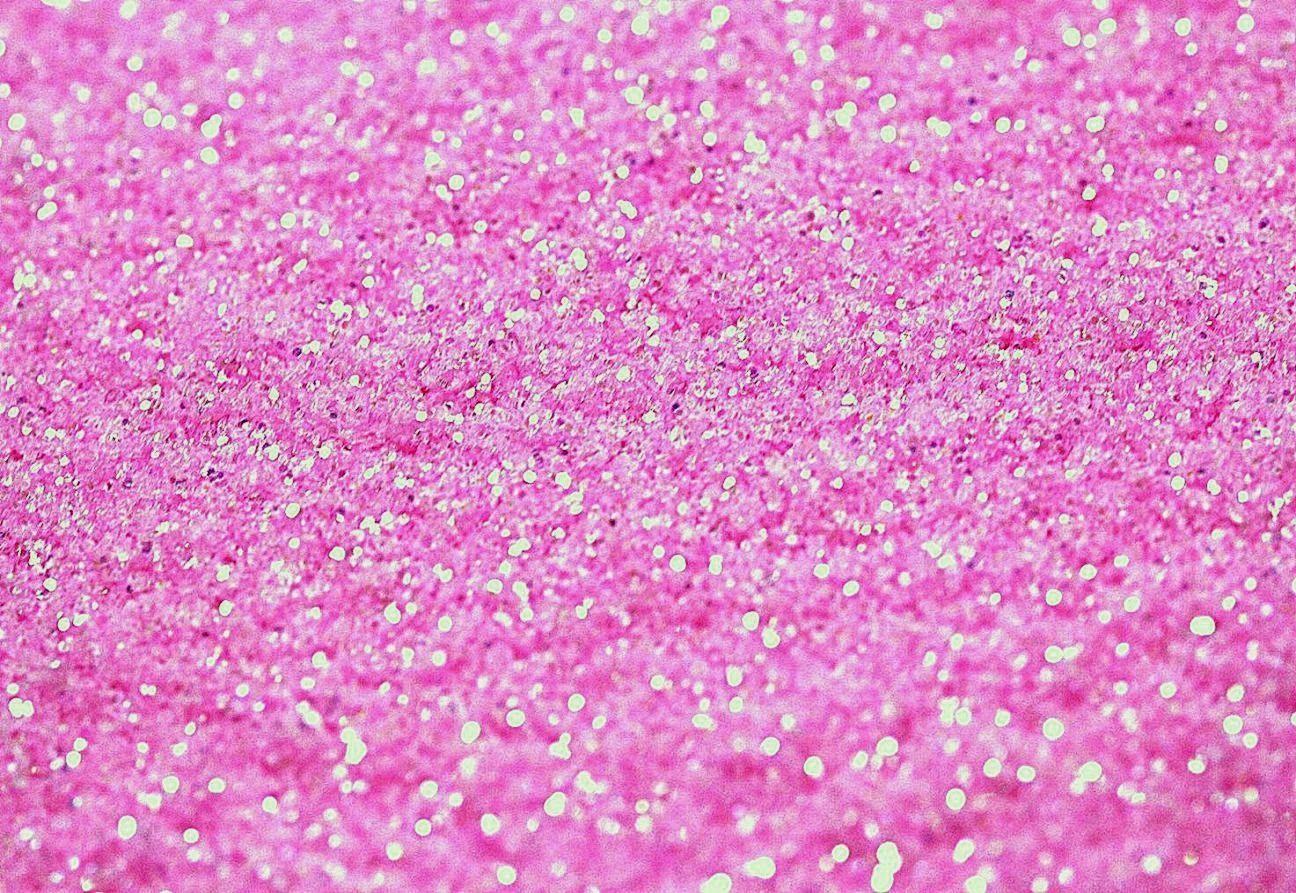 Top 95+ about blue and pink glitter wallpaper Update 2023