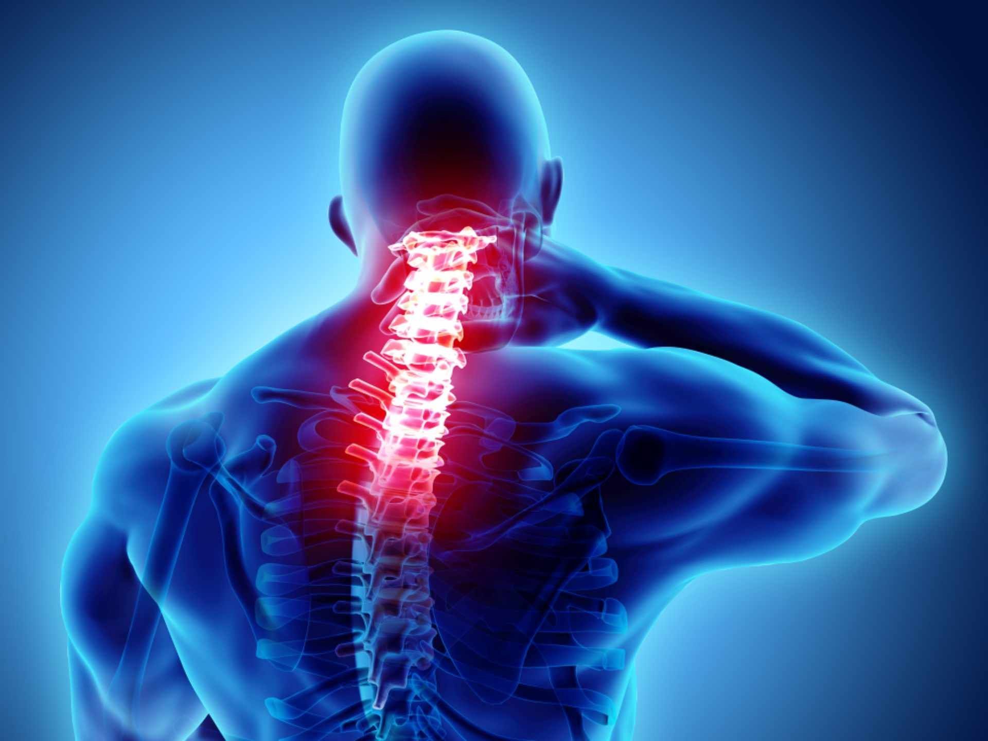 1920x1440 Neck Shoulder Pain. New Edge Spine