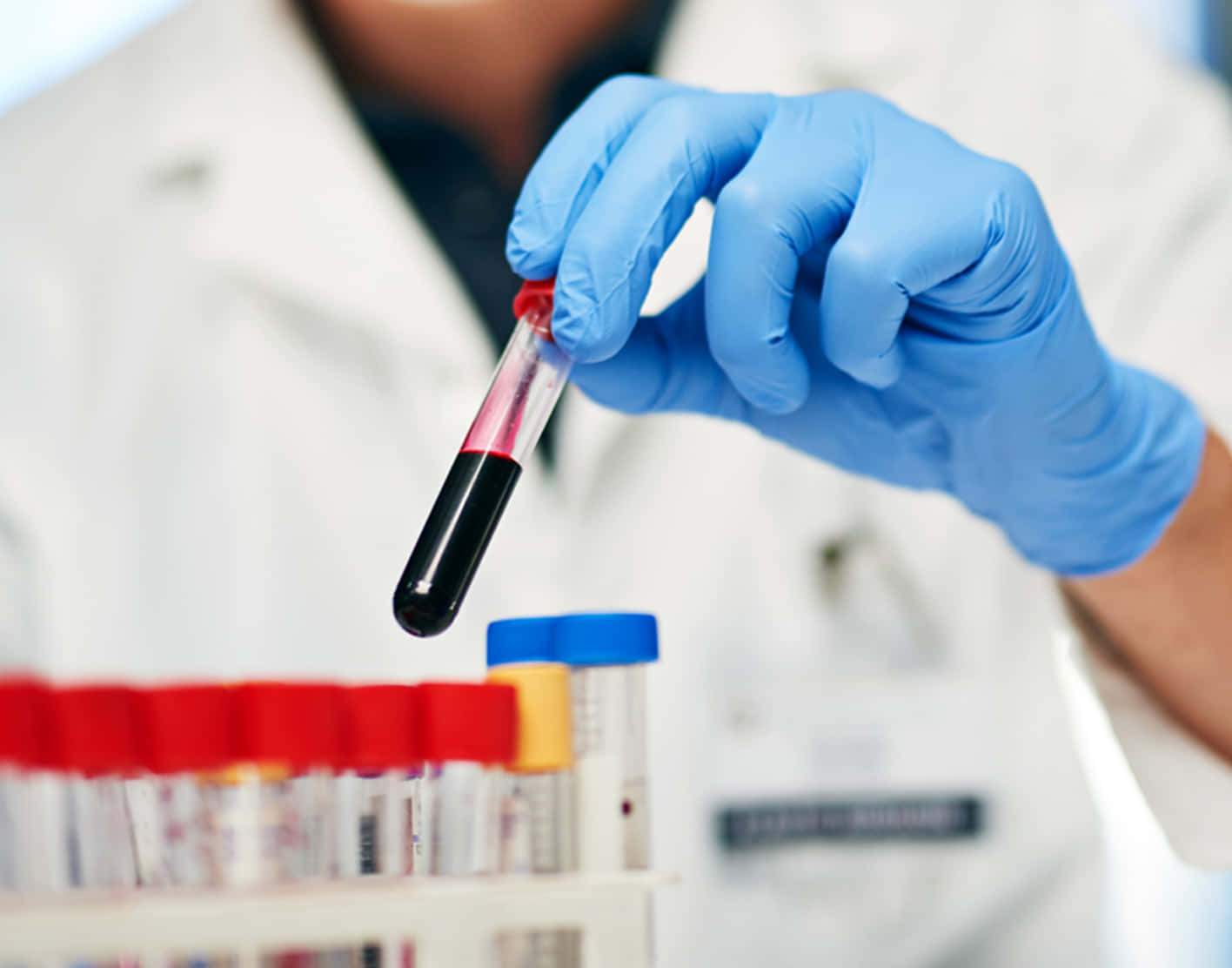 Artistic Get Blood Work Done Image in 4K Artistic Get Blood Work Done Image in 4K