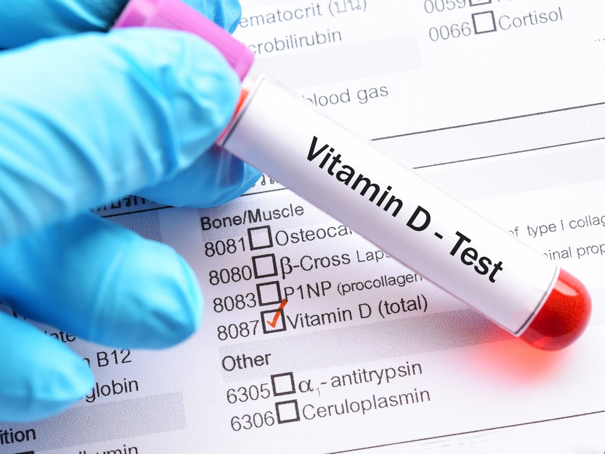 2000x1500 Hidden Benefits of Vitamin D