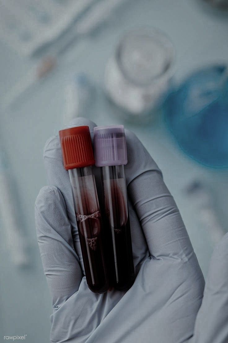 Artistic How To Get Blood Work Done Wallpaper for Your Screen Artistic How To Get Blood Work Done Wallpaper for Your Screen