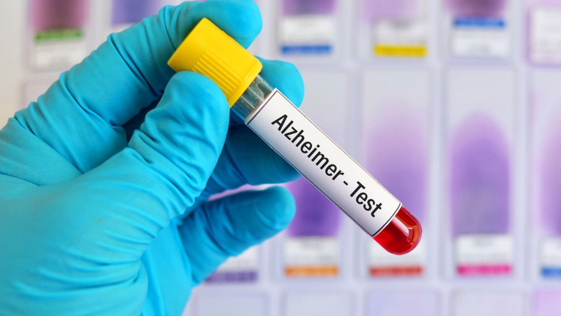 1920x1080 Simple blood test may accurately detect