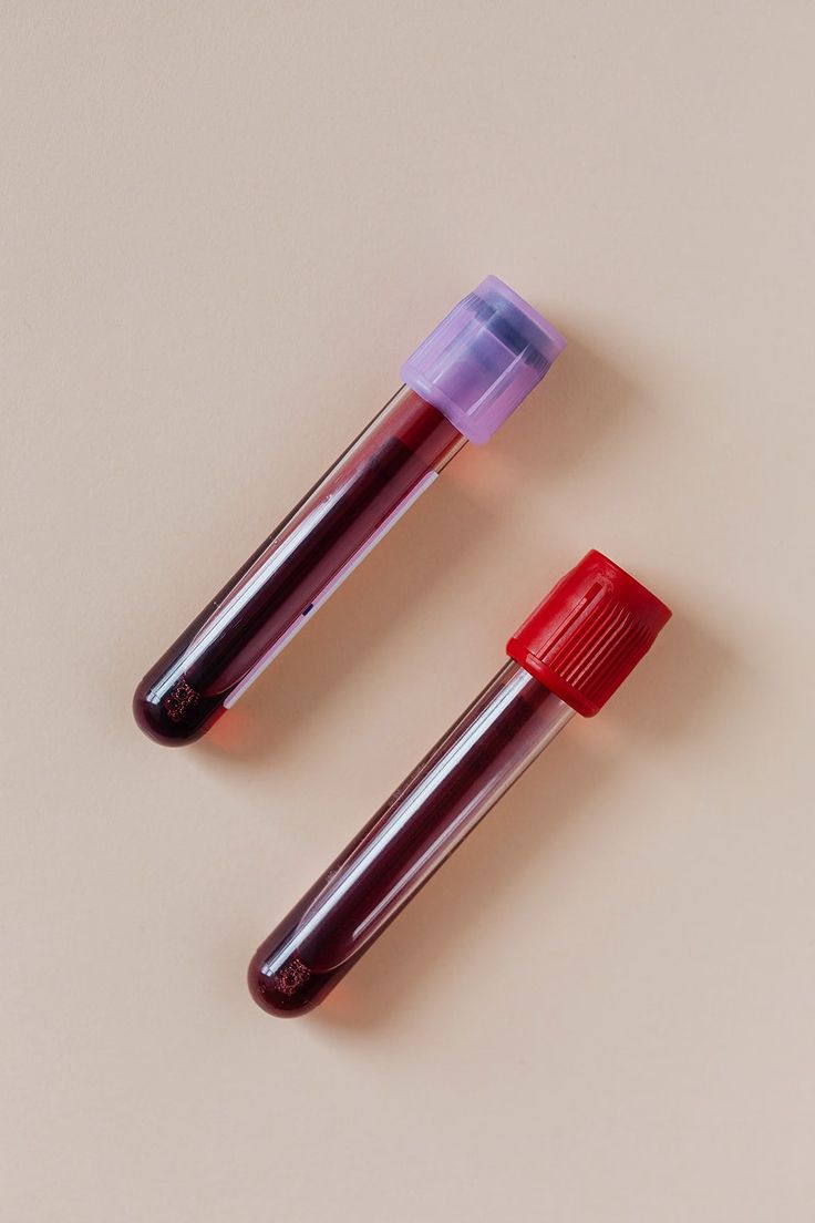 736x1104 Karolina / Kaboompics about blood tube
