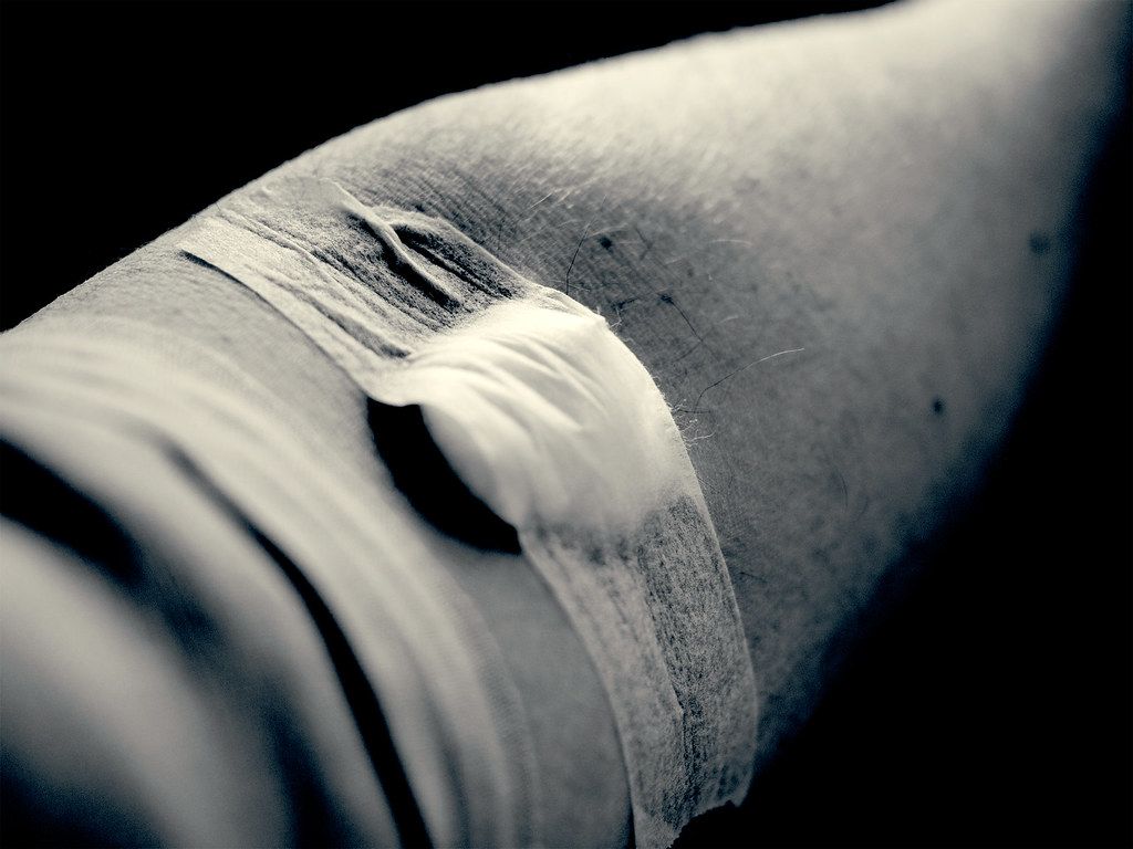 1024x768 Blood test