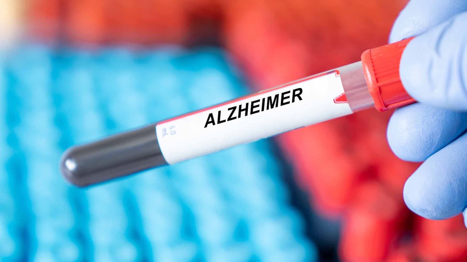 1600x900 New Blood Test Identifies Alzheimer's