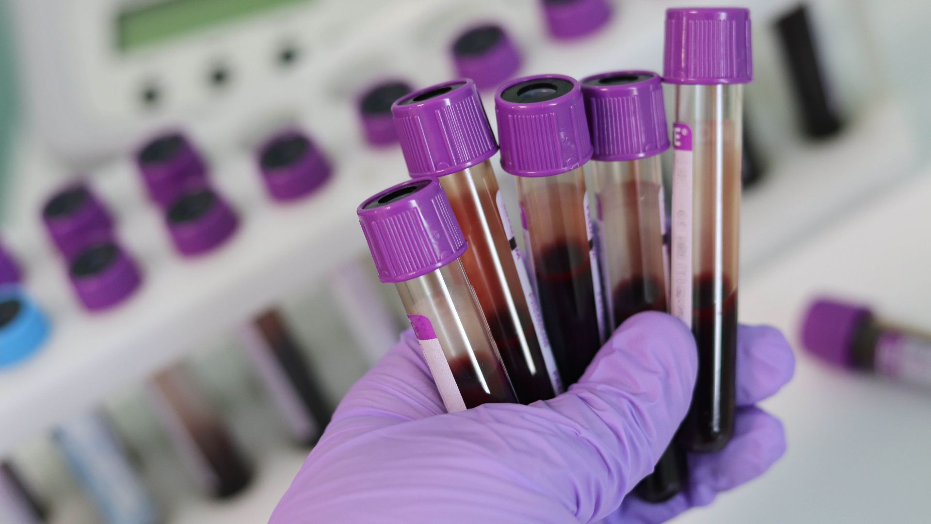 Beautiful How Do I Get A Blood Test Wallpaper Photography Beautiful How Do I Get A Blood Test Wallpaper Photography