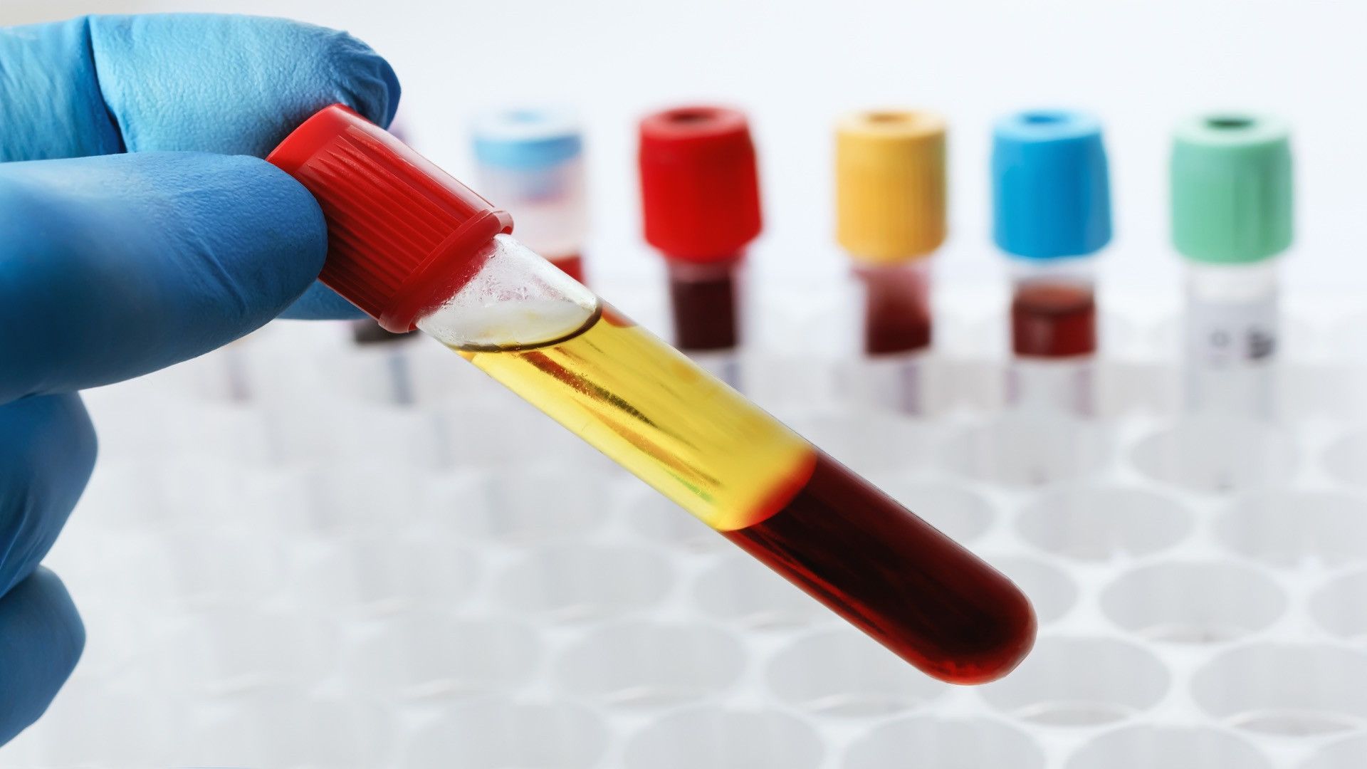 1920x1080 New blood test detects lethal cancers