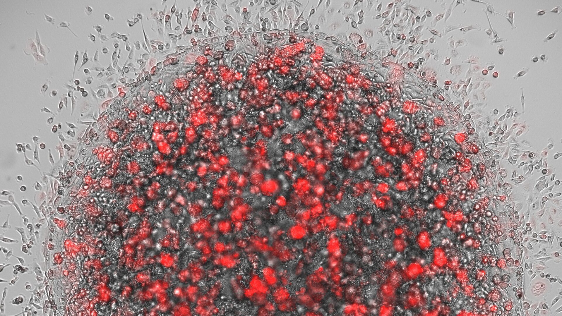 1920x1080 3D bioprinting of collagen the right collagen for your workflow