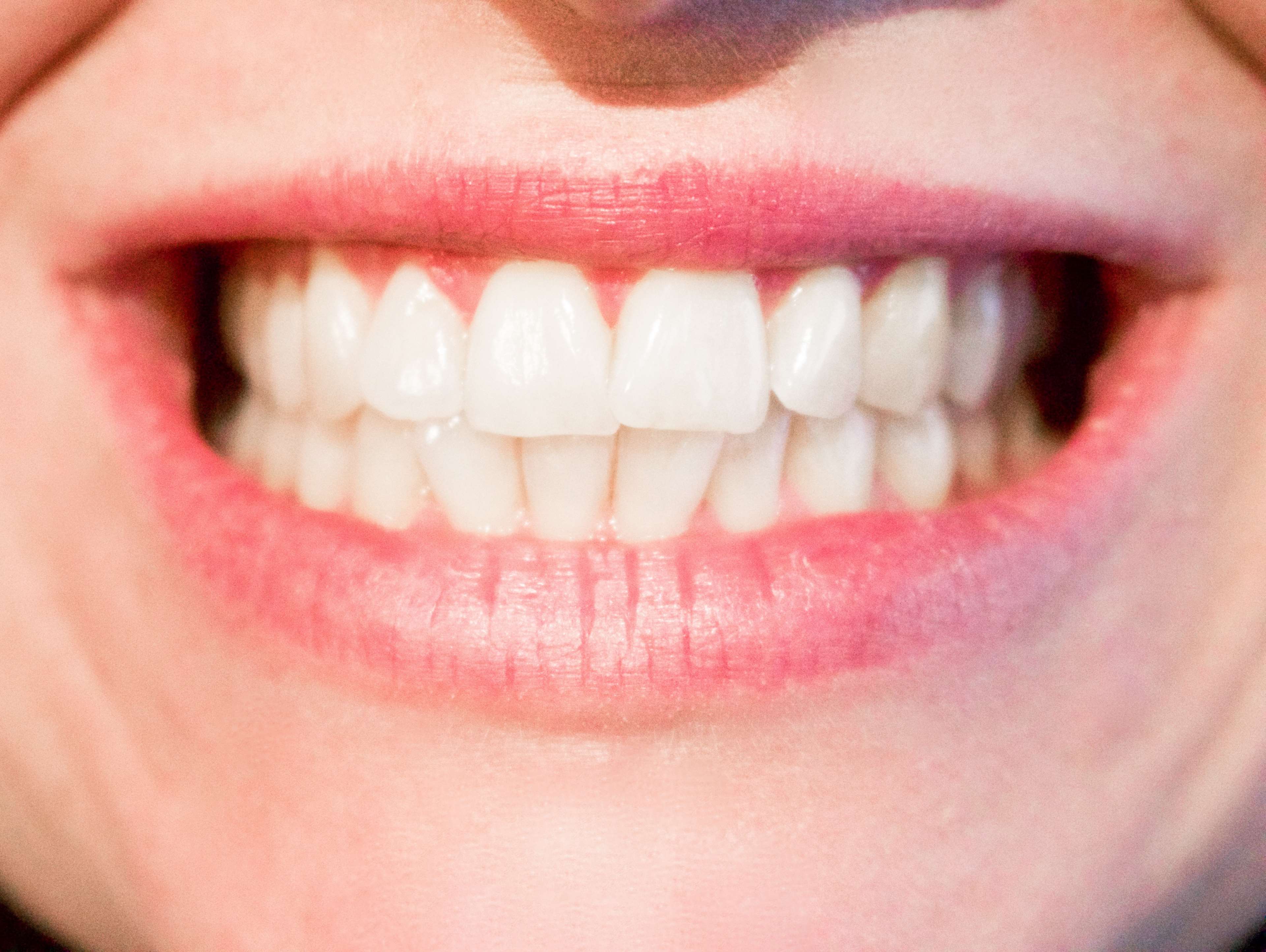3840x2889 care, caries, cavity, checkup, clinic, dental