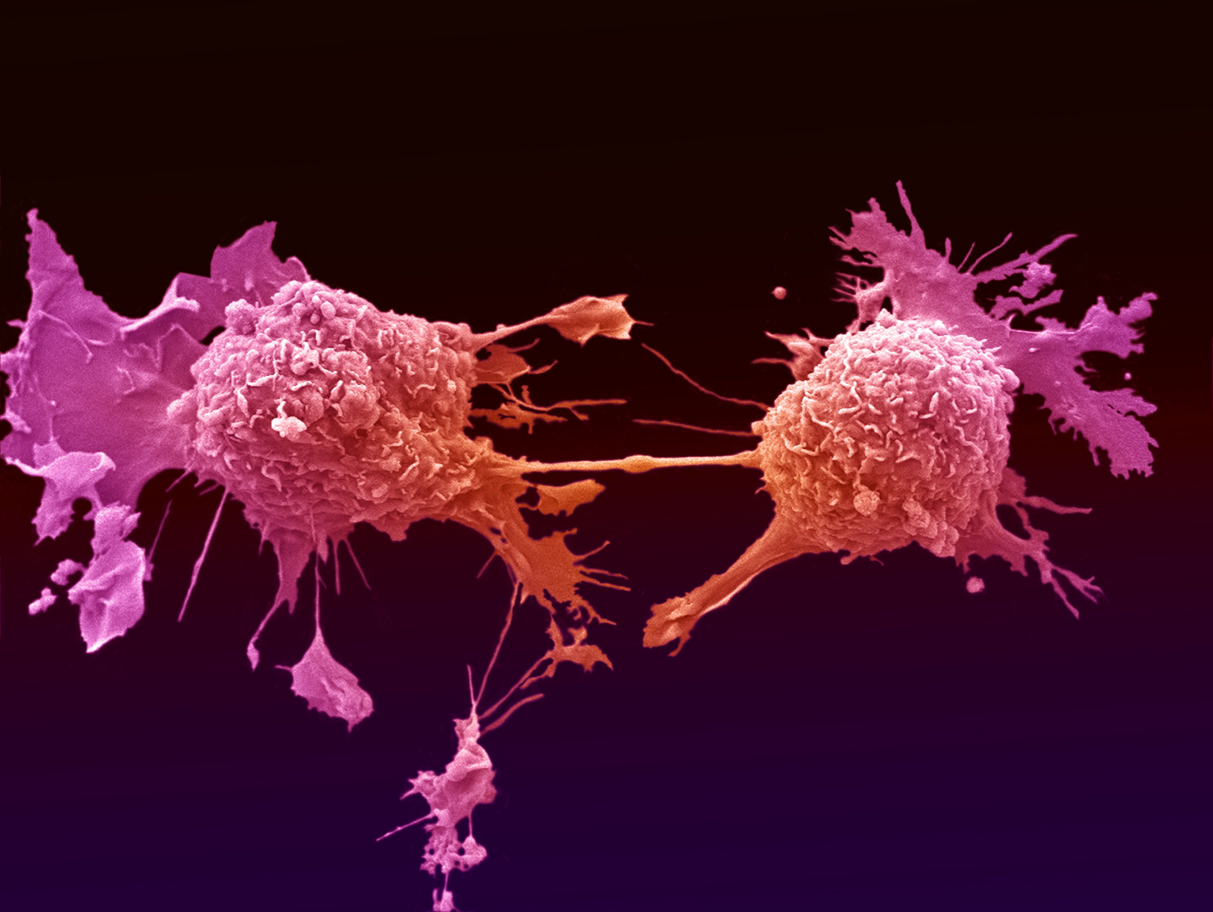 Cancer Cell Wallpapers - Top Free Cancer Cell Backgrounds - WallpaperAccess