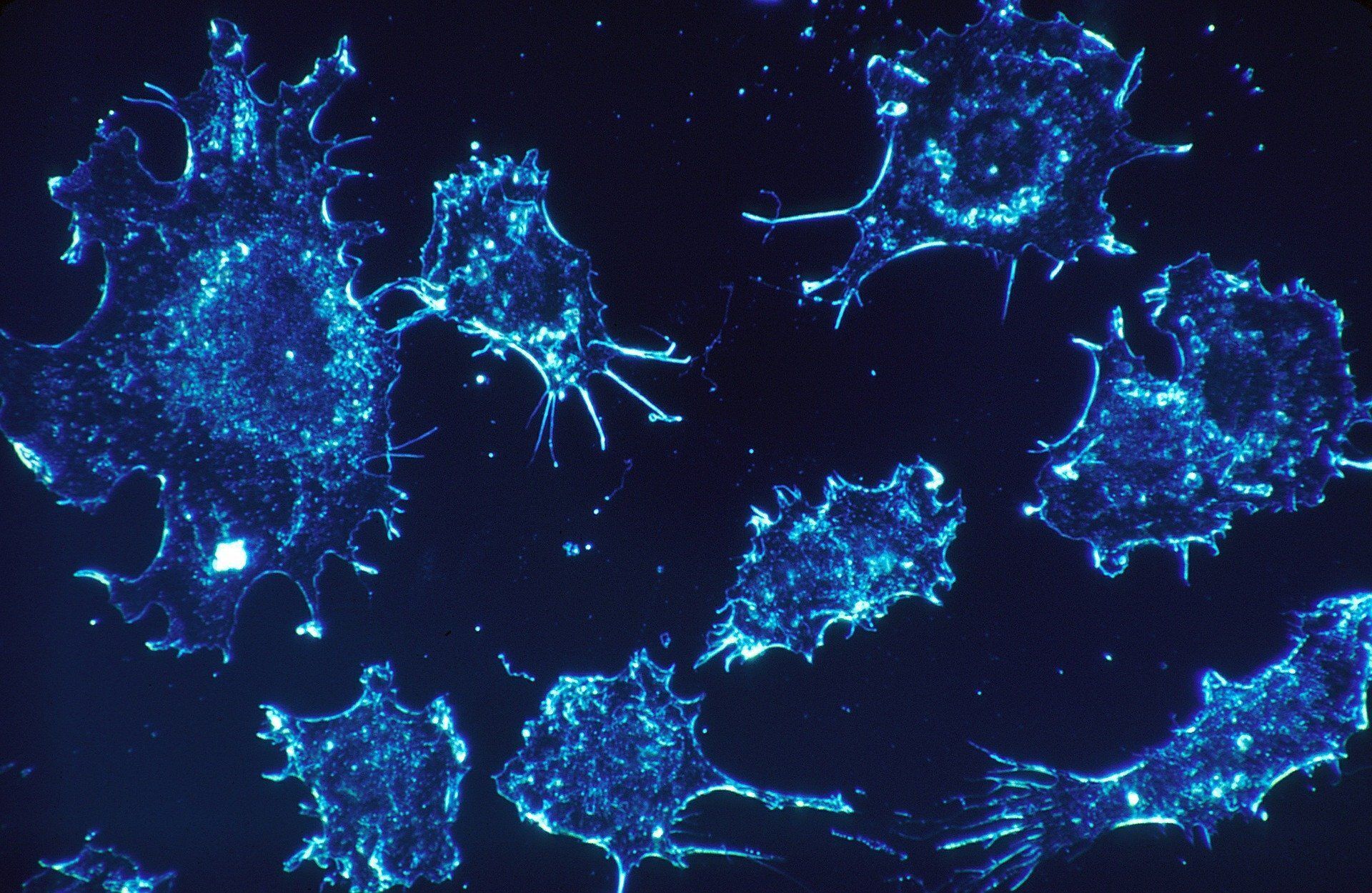1920x1250 Cancer cells that spread to different