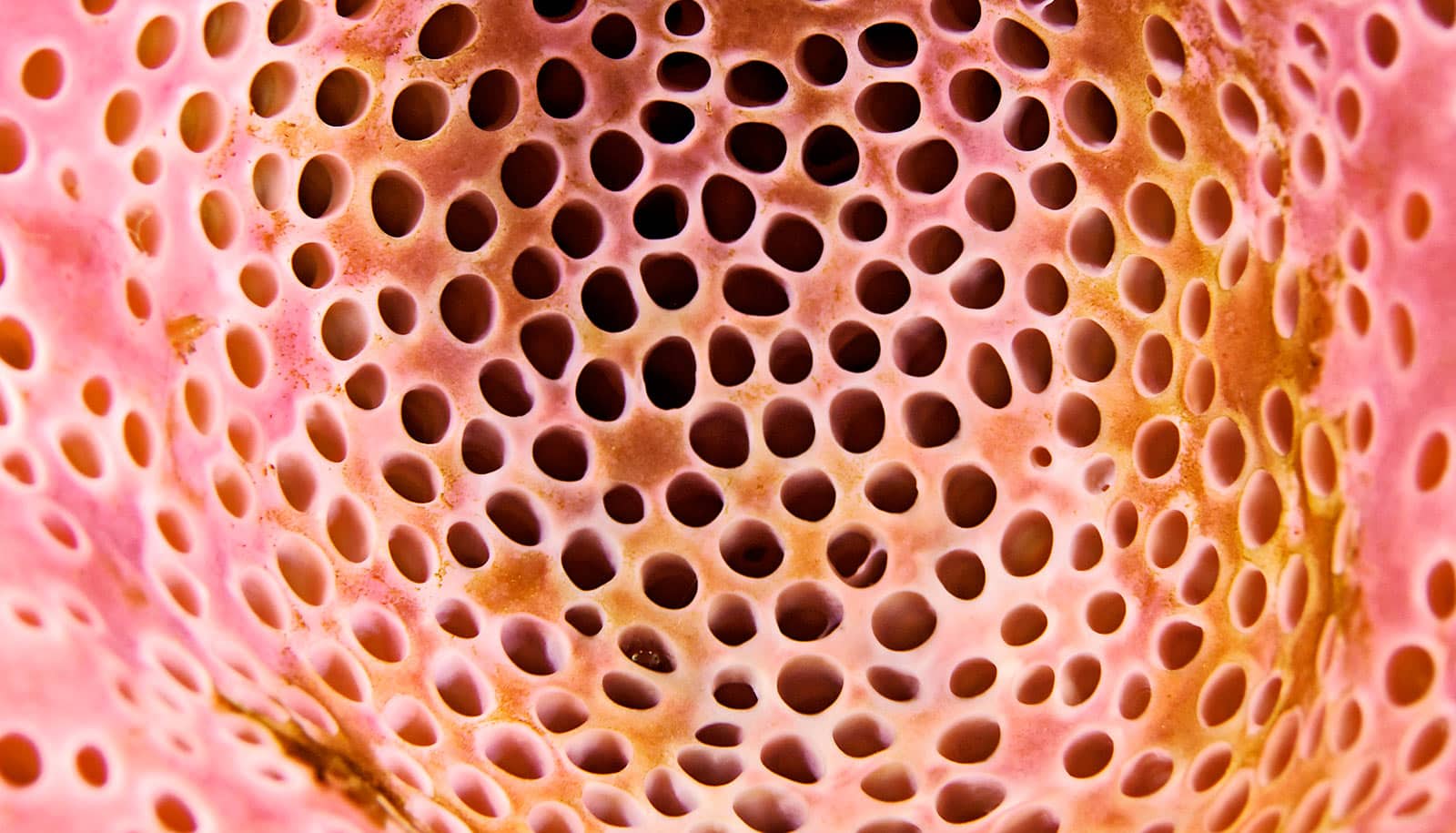 1600x915 You may suffer from trypophobia