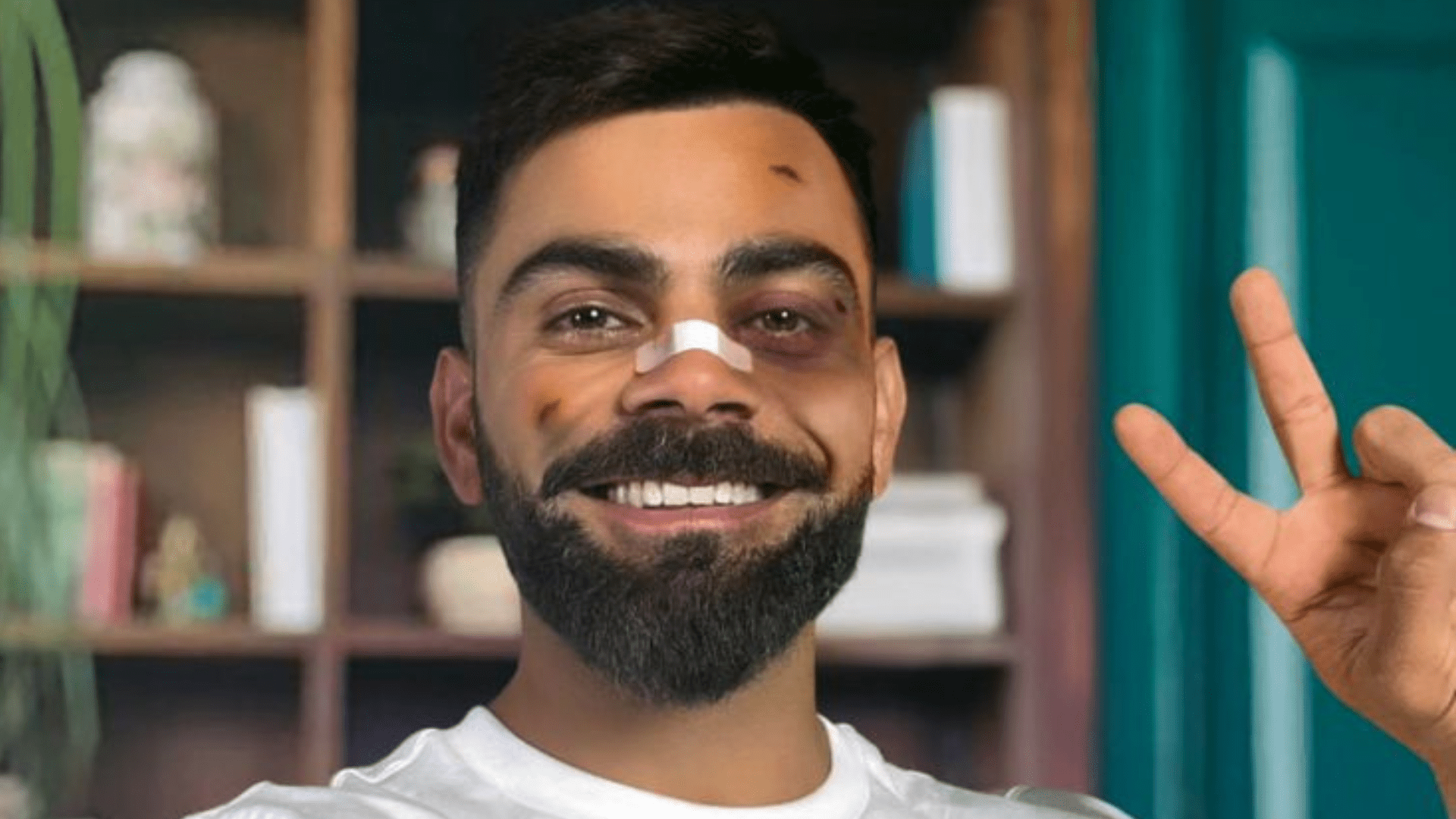 1920x1080 Virat Kohli Sports a Black Eye