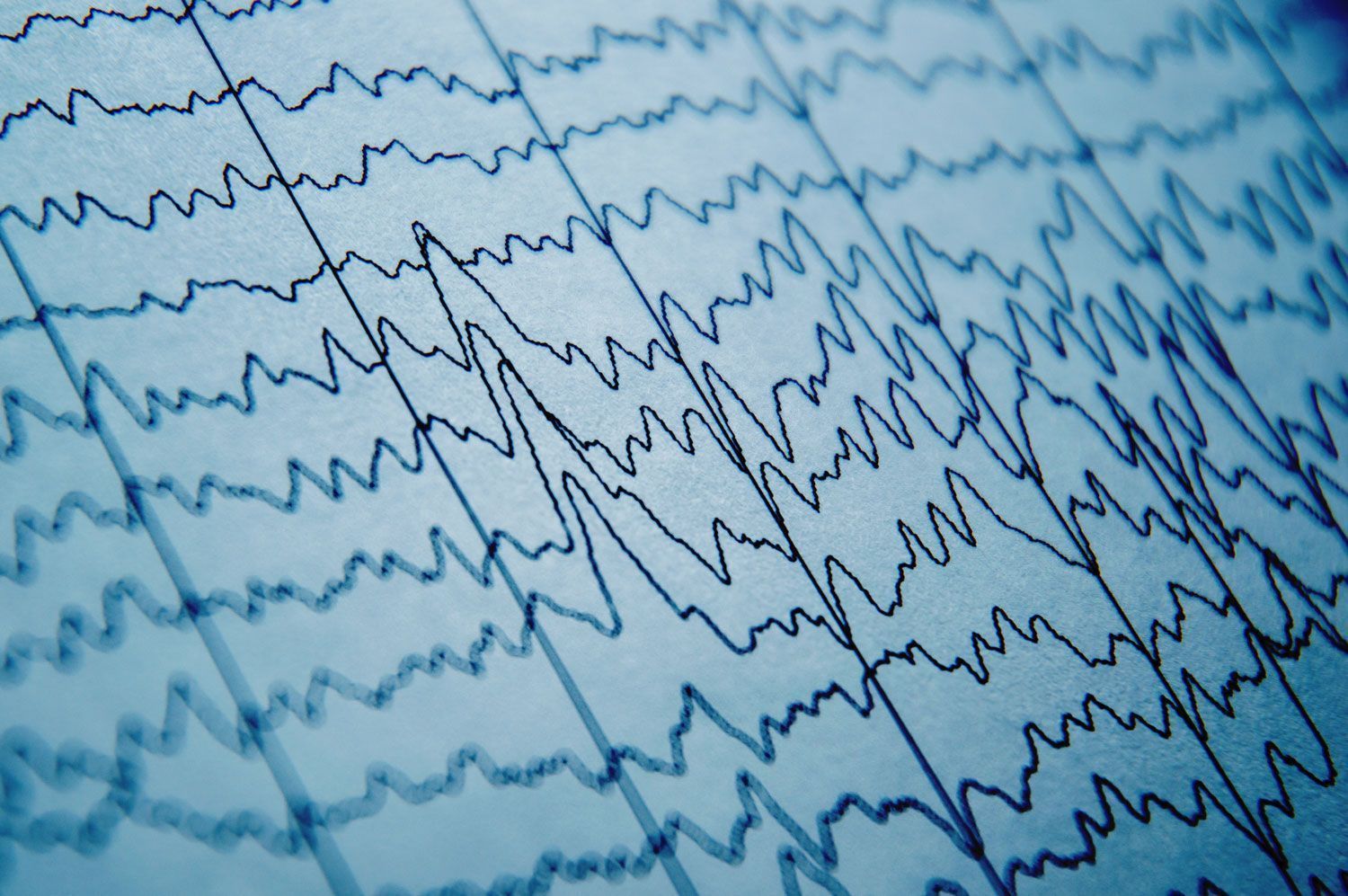 1500x997 Out Of Sync Brain Waves May Underlie