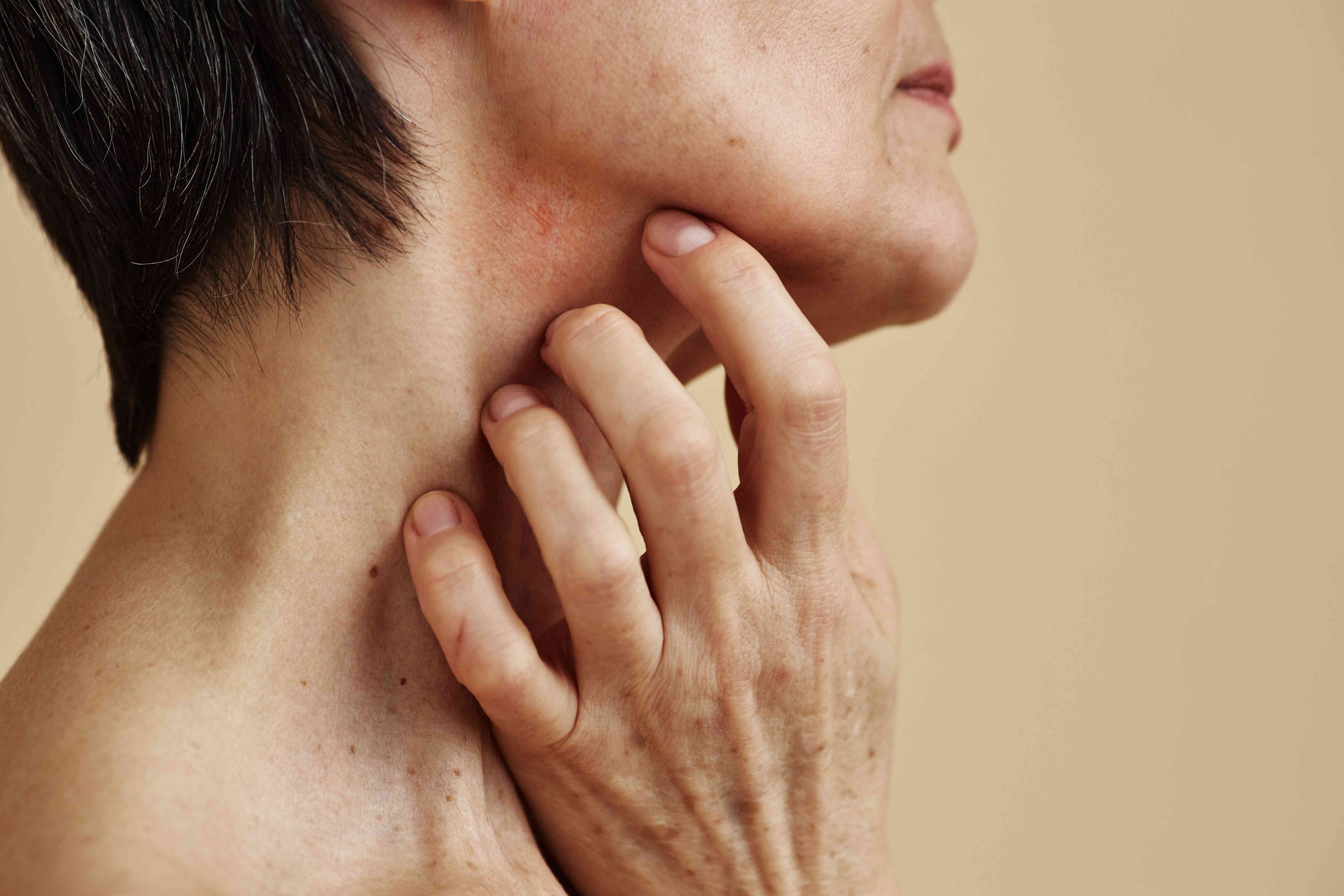 6720x4480 Common Allergy Rashes: Picture