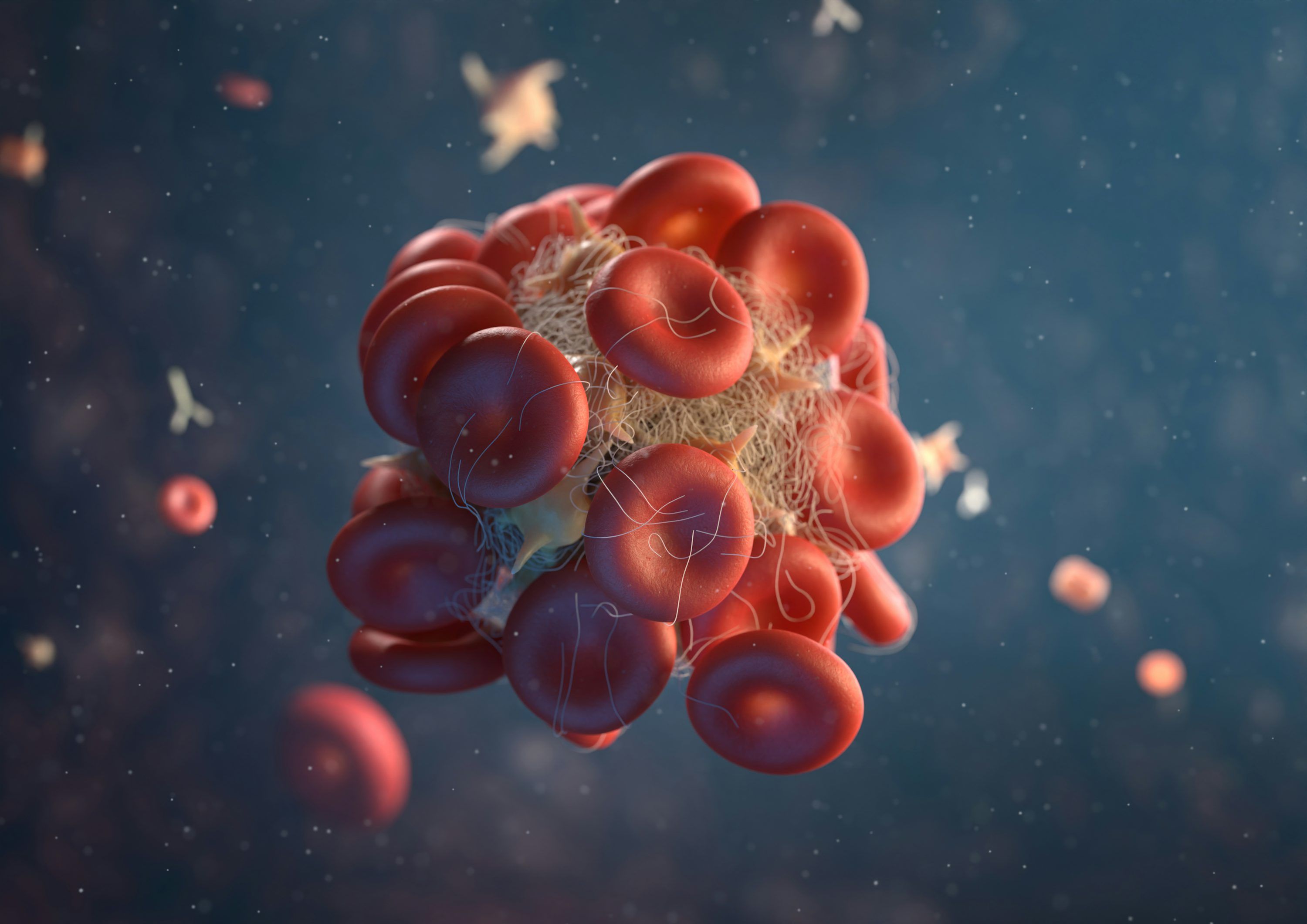 3000x2121 Blood Clot Picture. Download Free