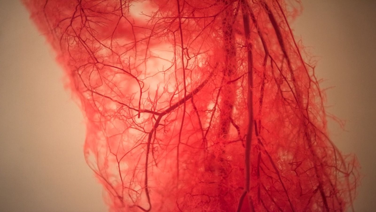 1600x900 Arterial Disease The Texas Heart