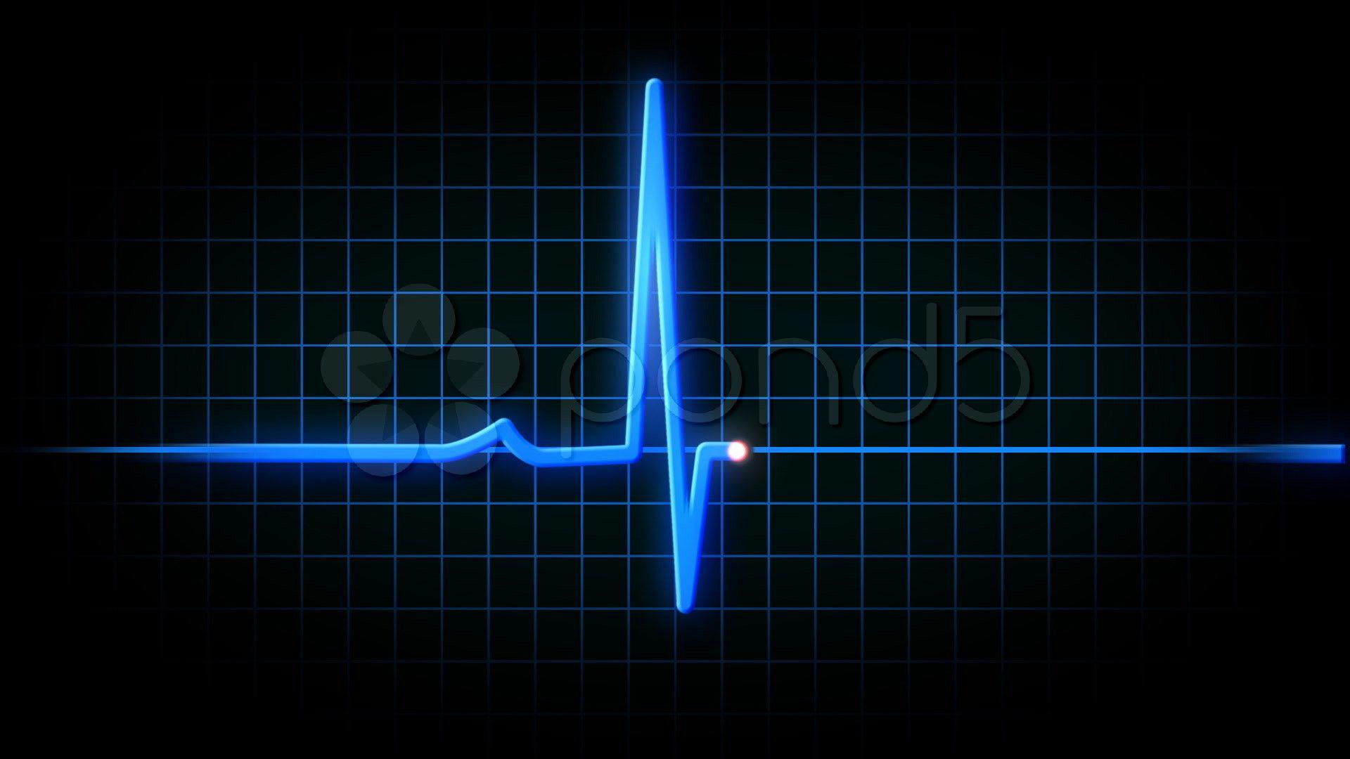 Heart Monitor Flatline Wallpapers - Top Free Heart Monitor Flatline  Backgrounds - WallpaperAccess