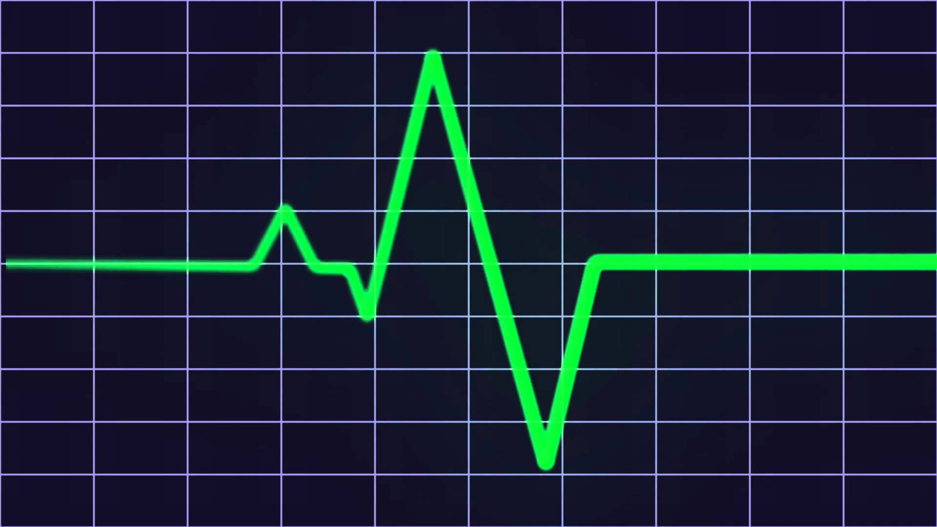 Под контролем пульса. Диаграмма пульса. График сердцебиения. График биения сердца. Диаграмма биения сердца.