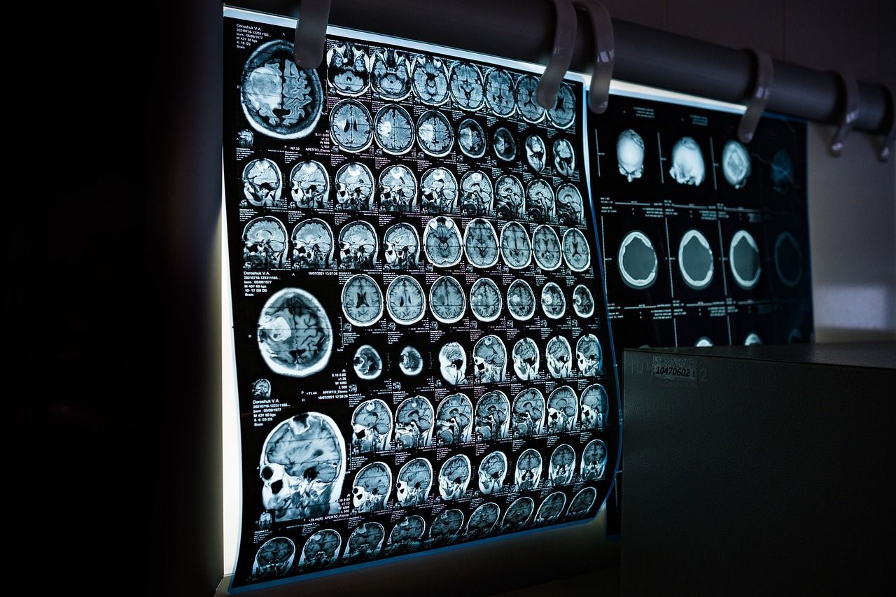 1280x853 Free Mri & Hospital Image