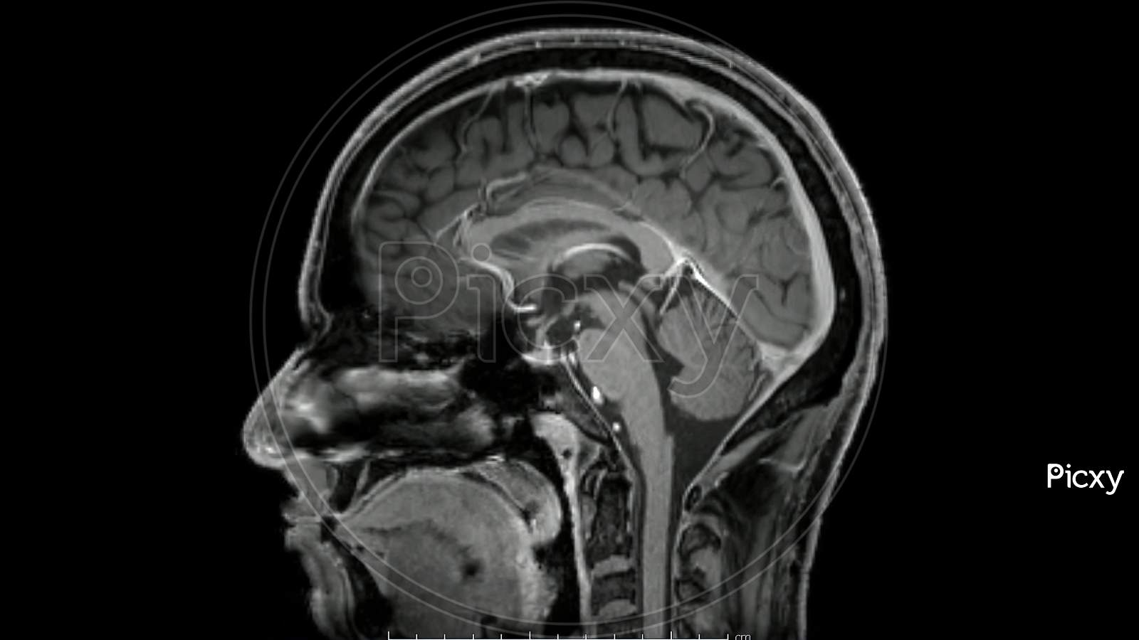 1600x900 Image of Magnetic resonance image