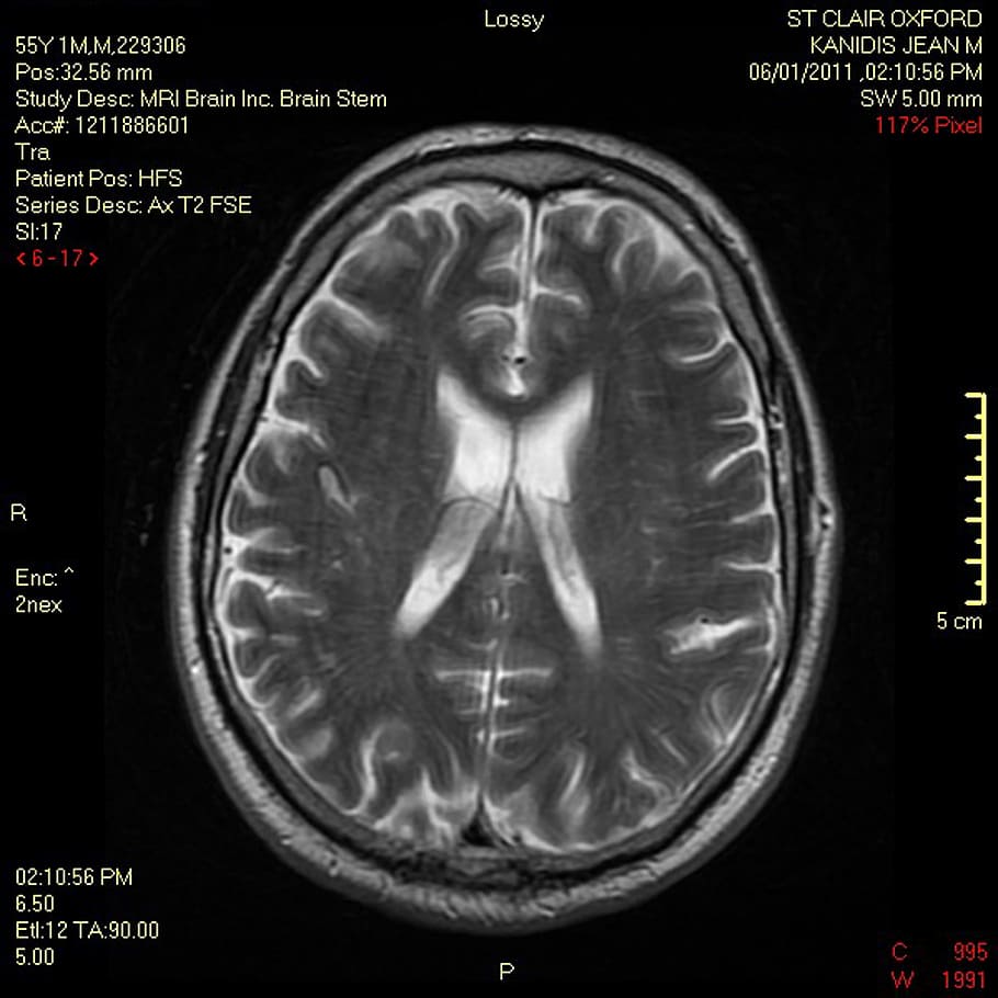 910x910 Magnetic resonance imaging 1080P, 2K