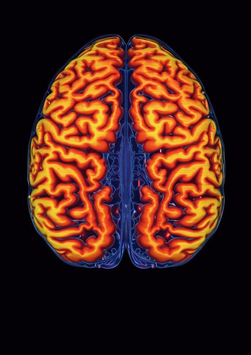 800x1131 Mri Or Ct Scan For Brain Image. Free