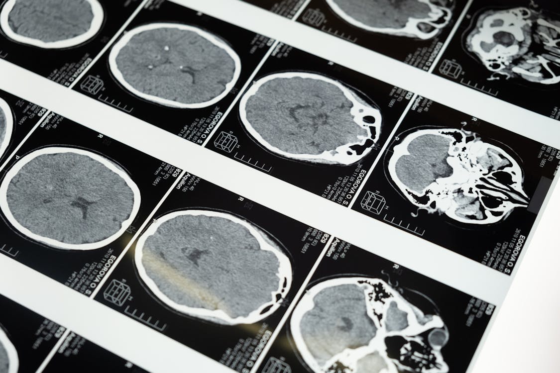 1125x750 MRI Image of the Brain · Free