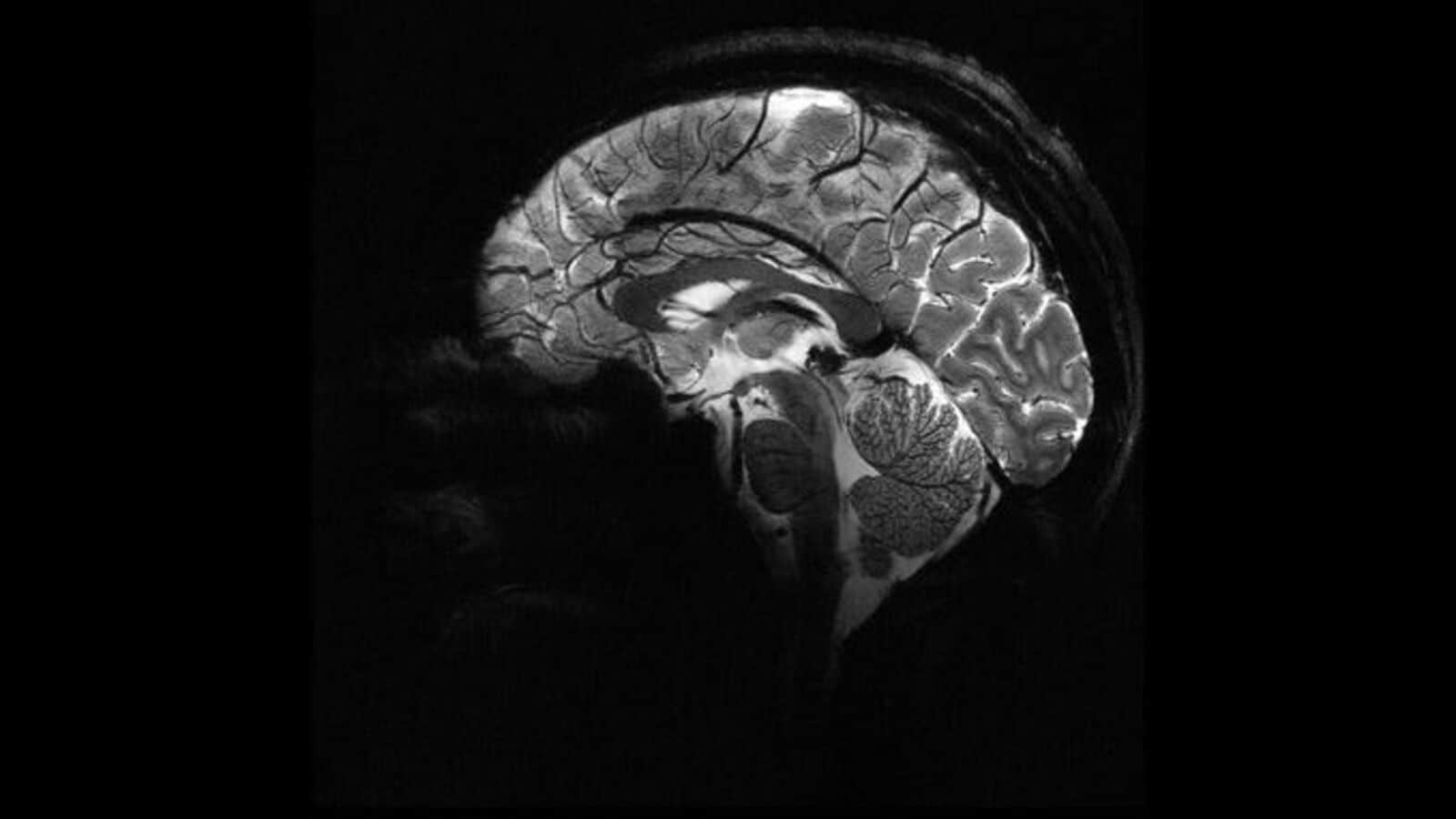 1600x900 Iseult MRI machine, world's most