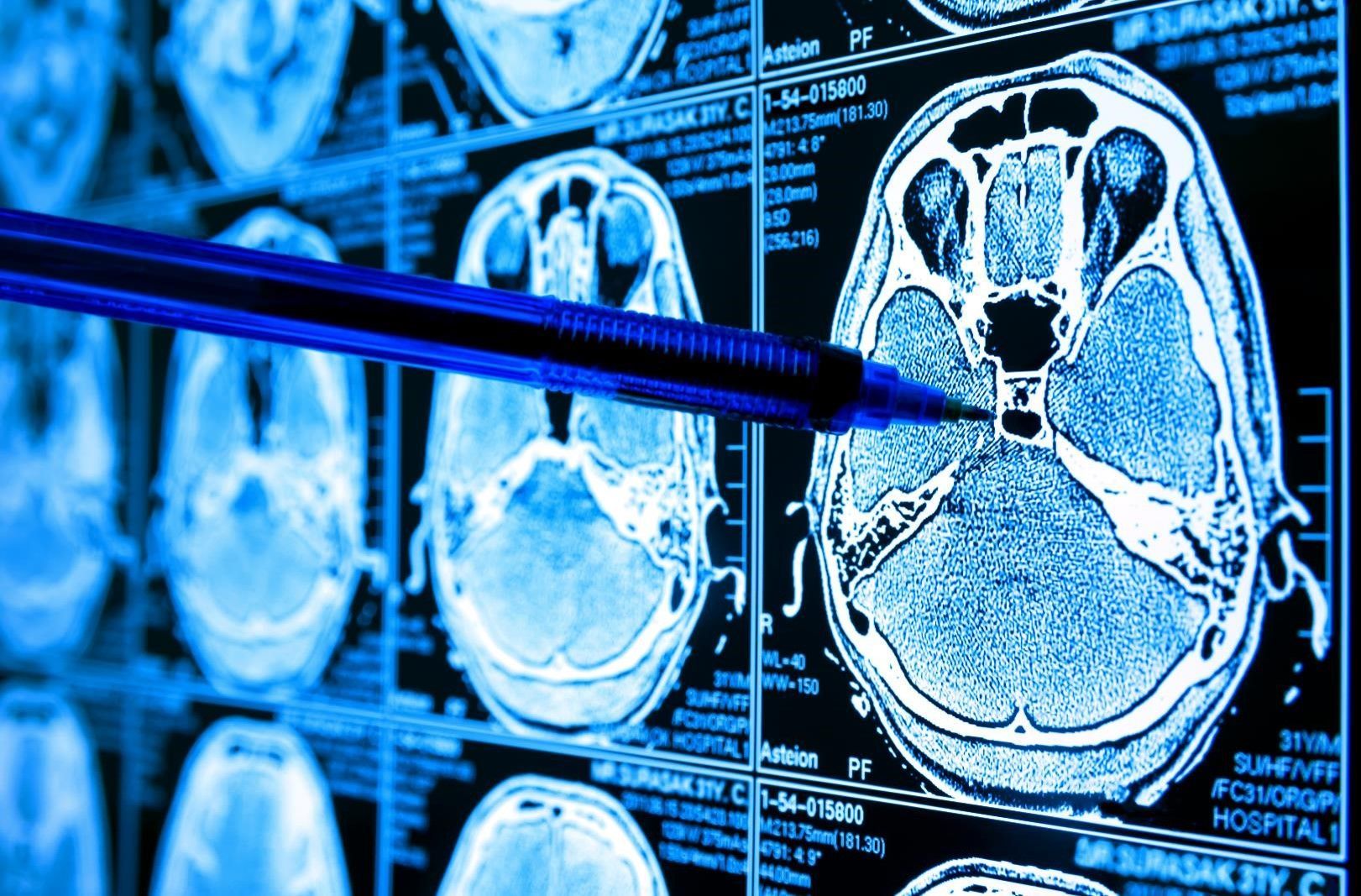 1621x1067 Higher Resolution MRI Image