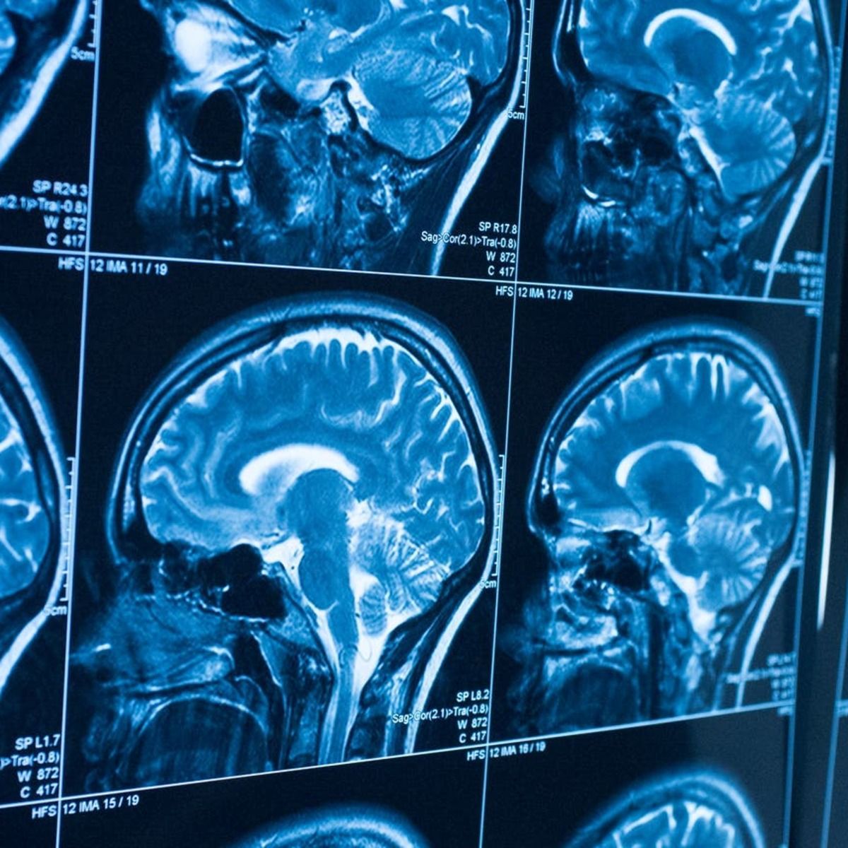 1200x1200 Brain Tumor MRI Dataset