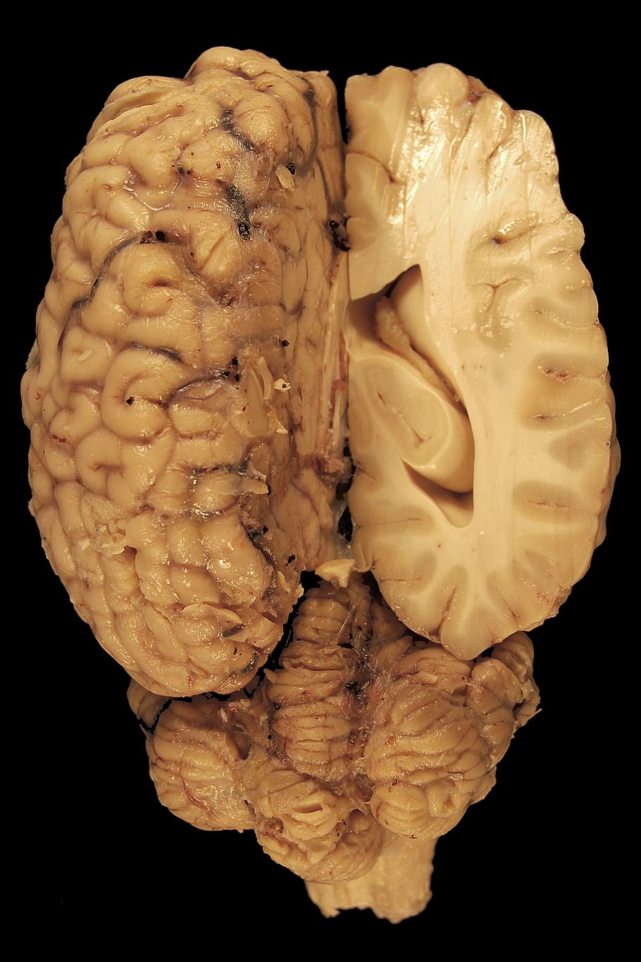 910x1365 HD wallpaper: brain illustration, anatomy, eyes, paerparat