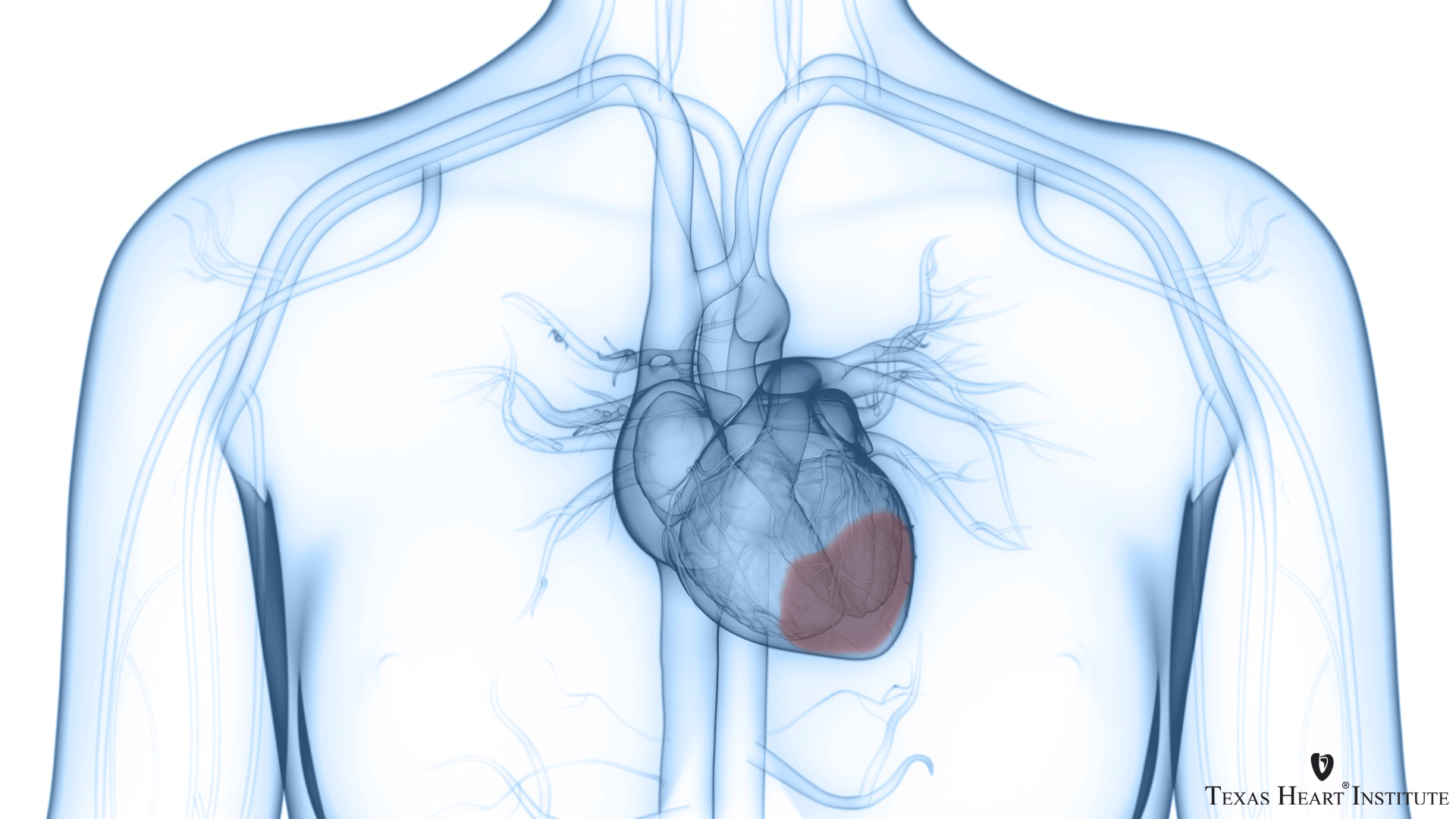 1920x1080 Groundbreaking Cardiovascular Gene