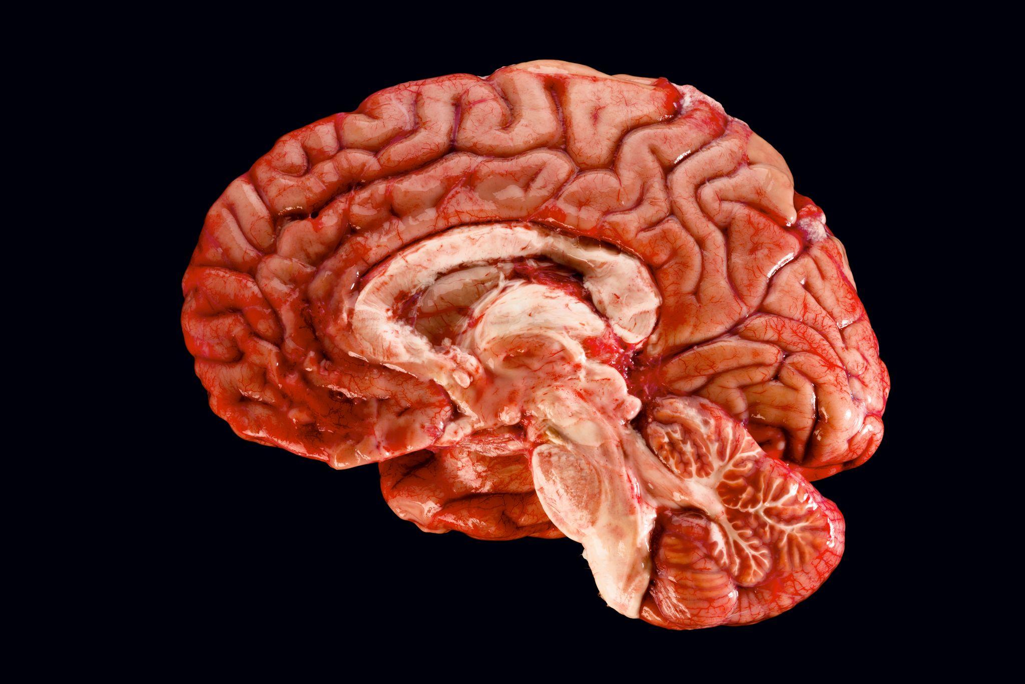 2048x1367 Brain wallpaper, Artistic, HQ Brain pictureK