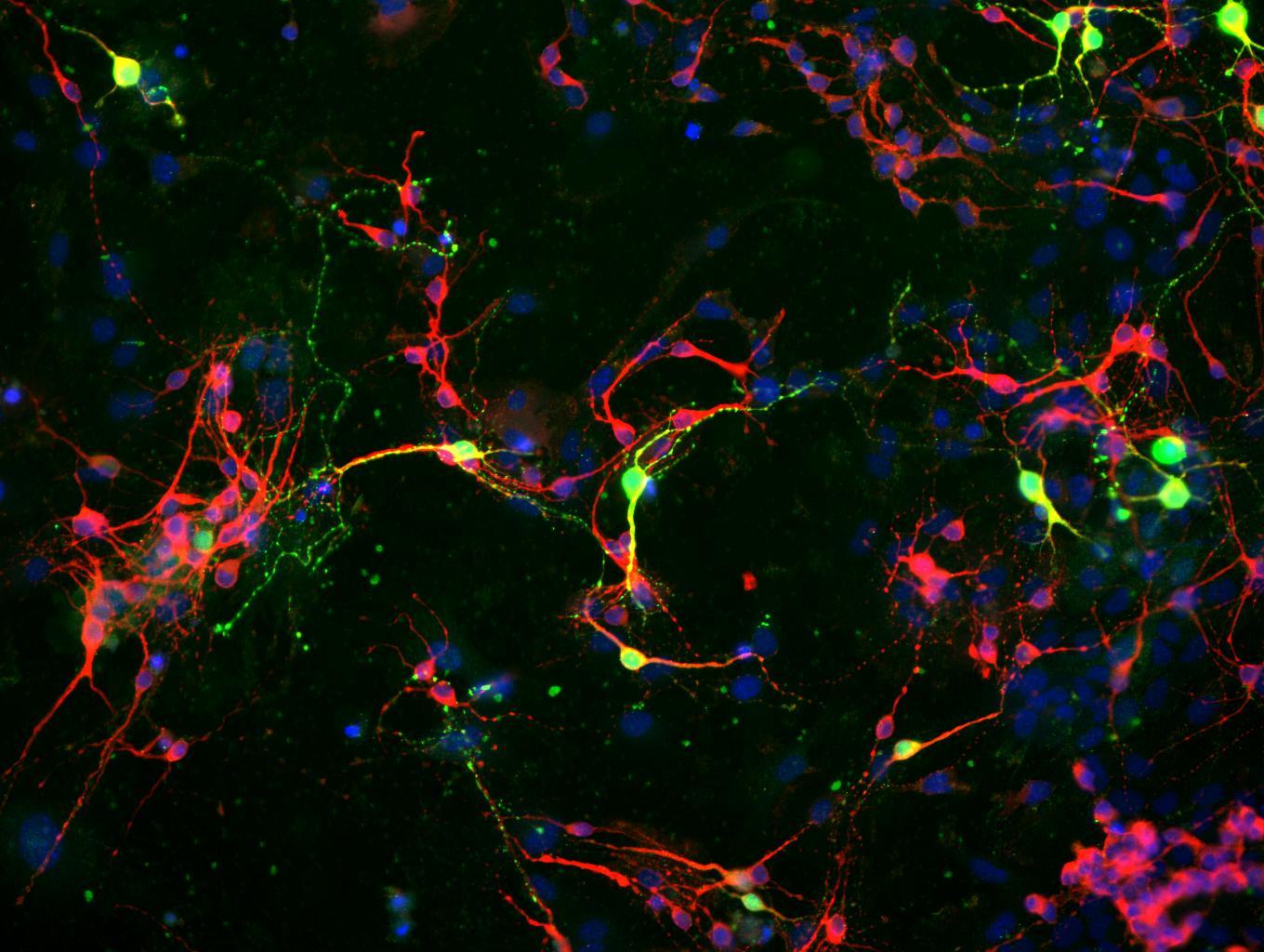 1360x1024 Neurons