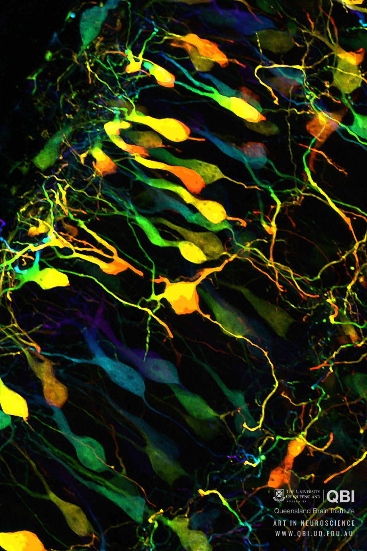 neurology-wallpapers-top-free-neurology-backgrounds-wallpaperaccess
