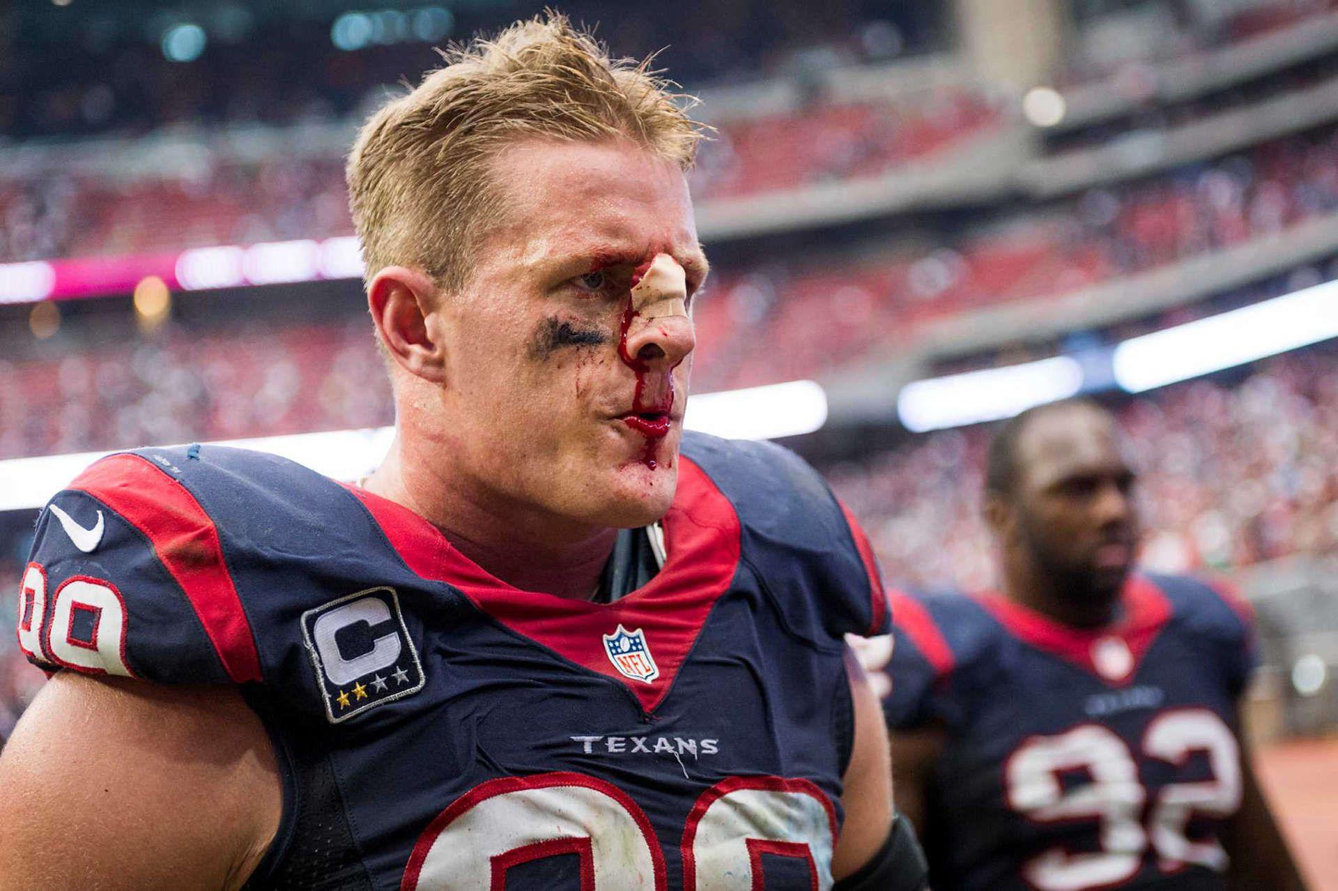 1920x1278 Jj watt. Wallpaper: J.J Watt Broken Nose