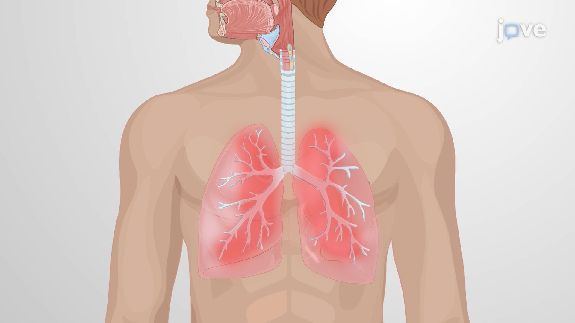 1920x1080 Common Respiratory Disorders