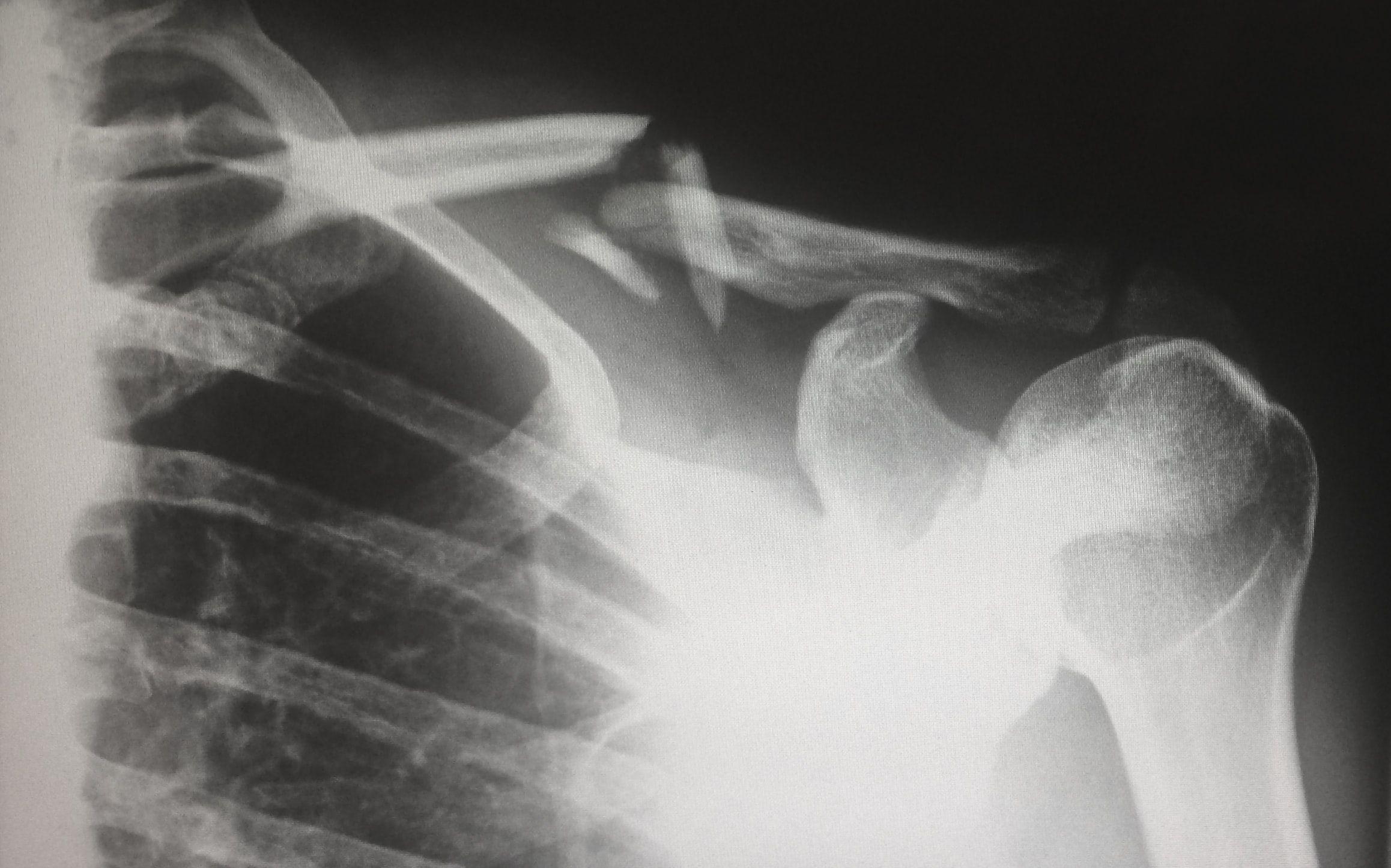 2316x1446 Injury Picture. Download Free Image