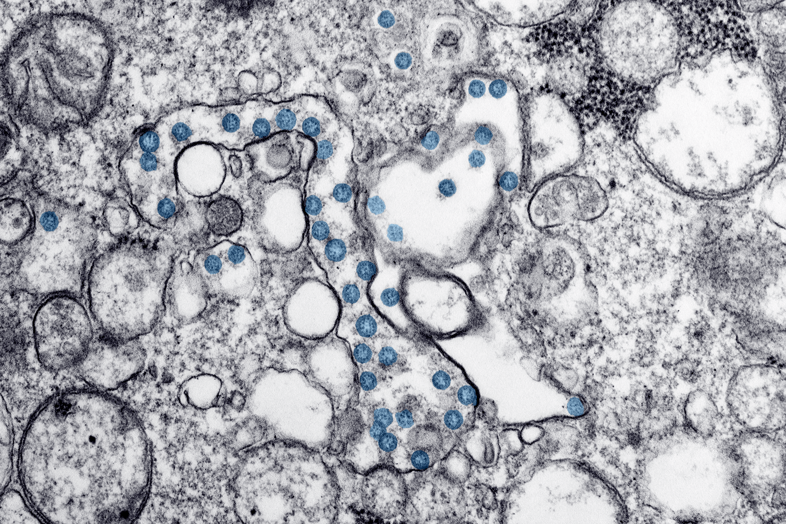3000x2000 Image Library. CDC Online Newsroom