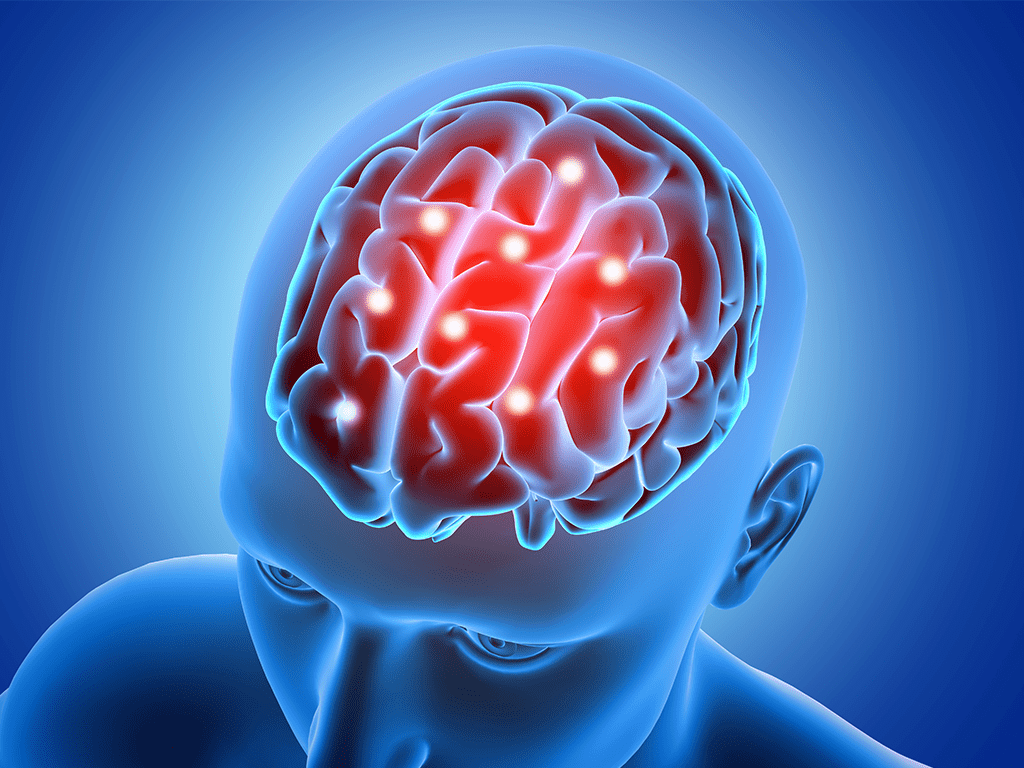 1024x768 Neurology Health Organization