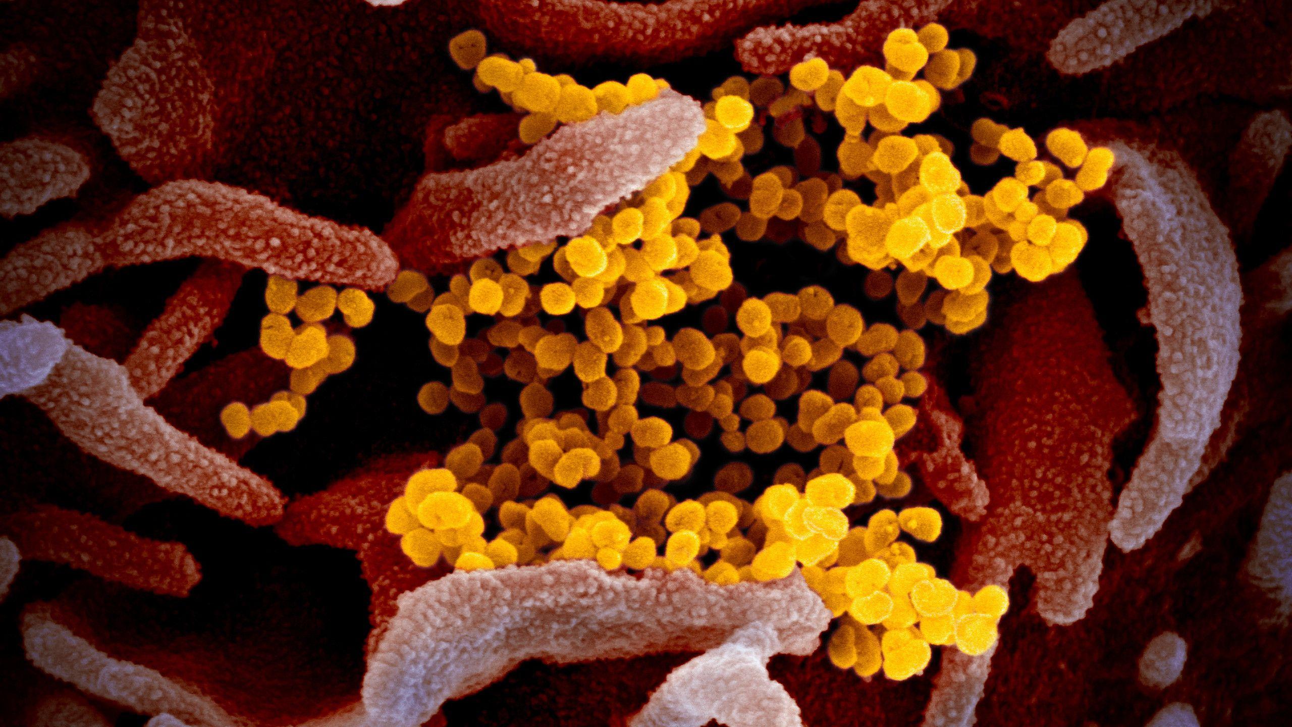 2560x1440 Coronavirus Albuquerque New Mexico KRQE News 13
