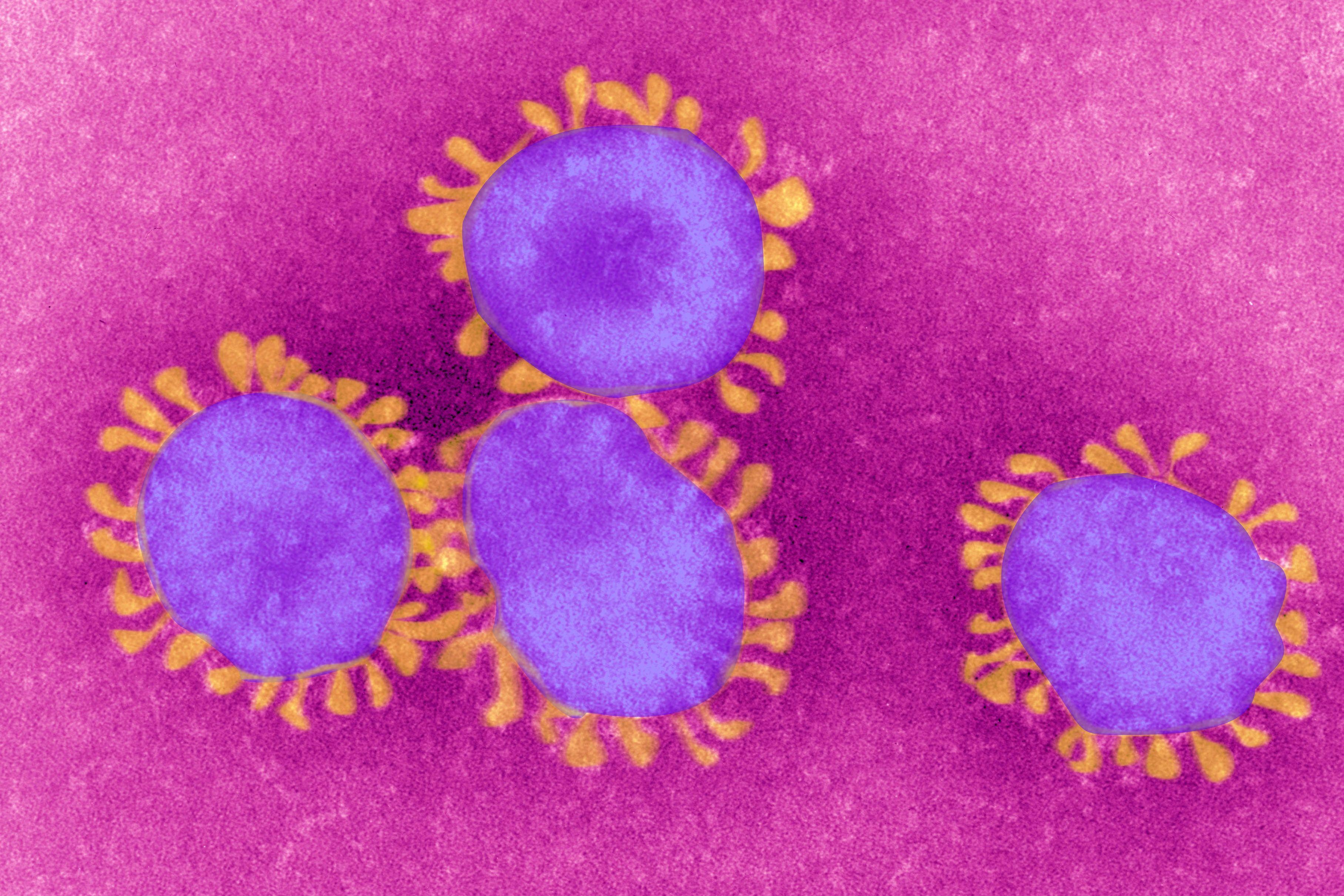 3630x2420 Should I, Uh, Be Worried About the Coronavirus Outbreak?